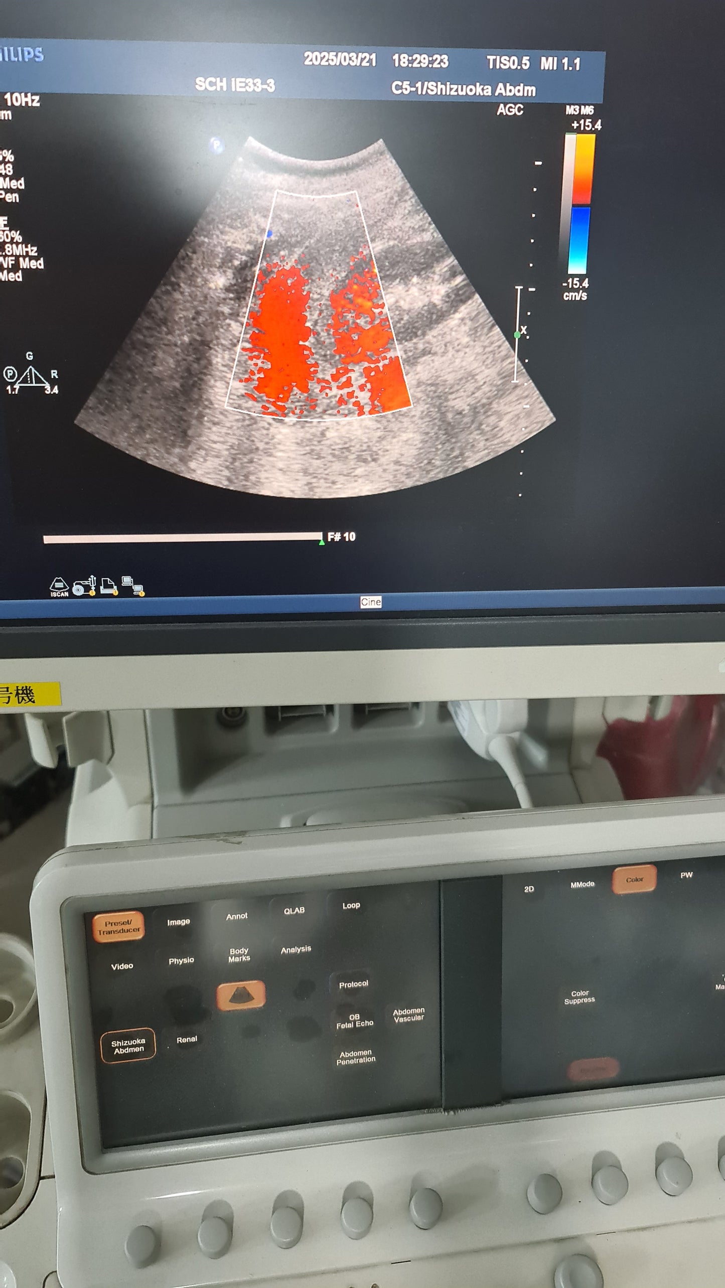 ...Philips C5-1 Convex Probe Checked DXB