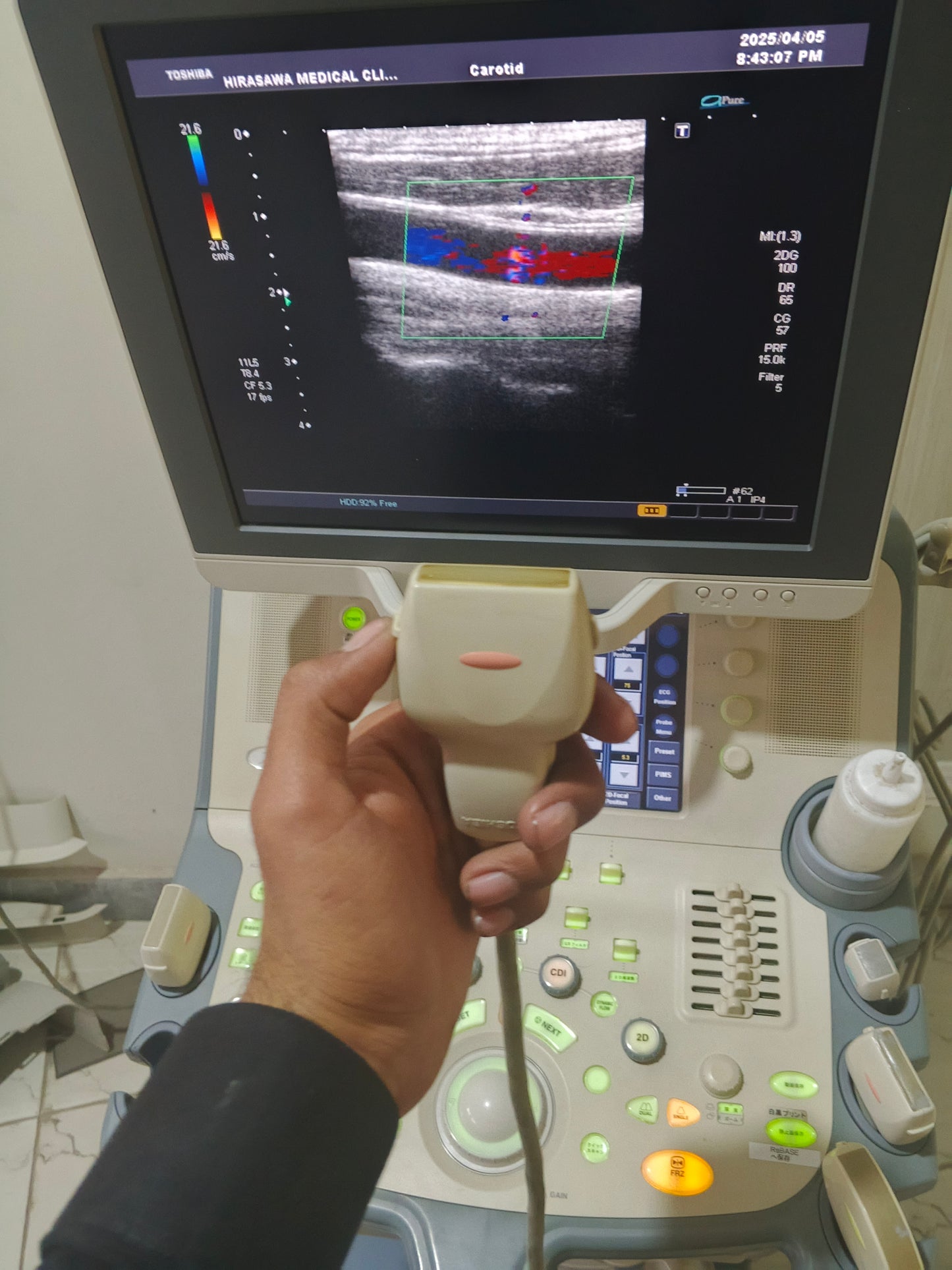 ..Toshiba PLT-704AT Linear probe