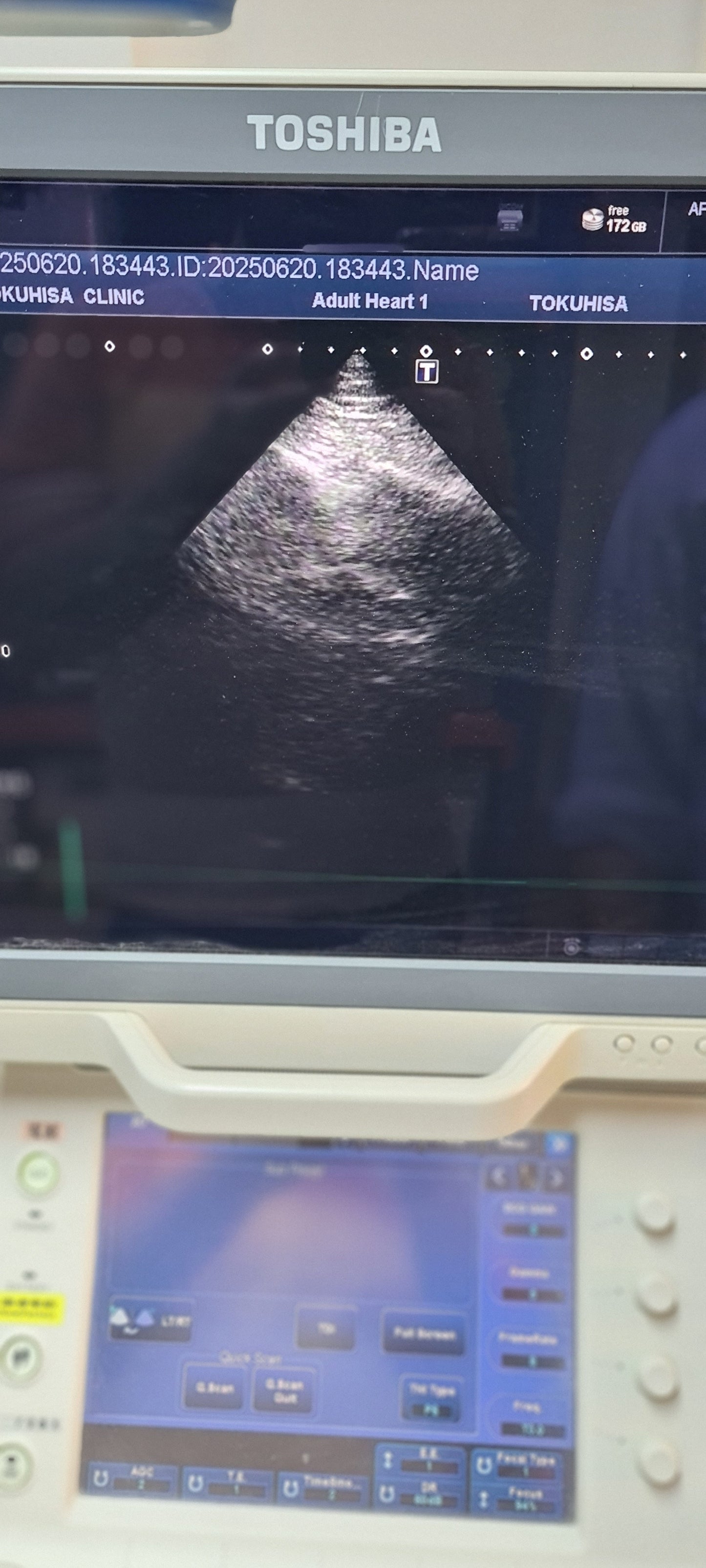 Toshiba PST-25BT Cardiac Probe SN: TDA12X4263 Dxb