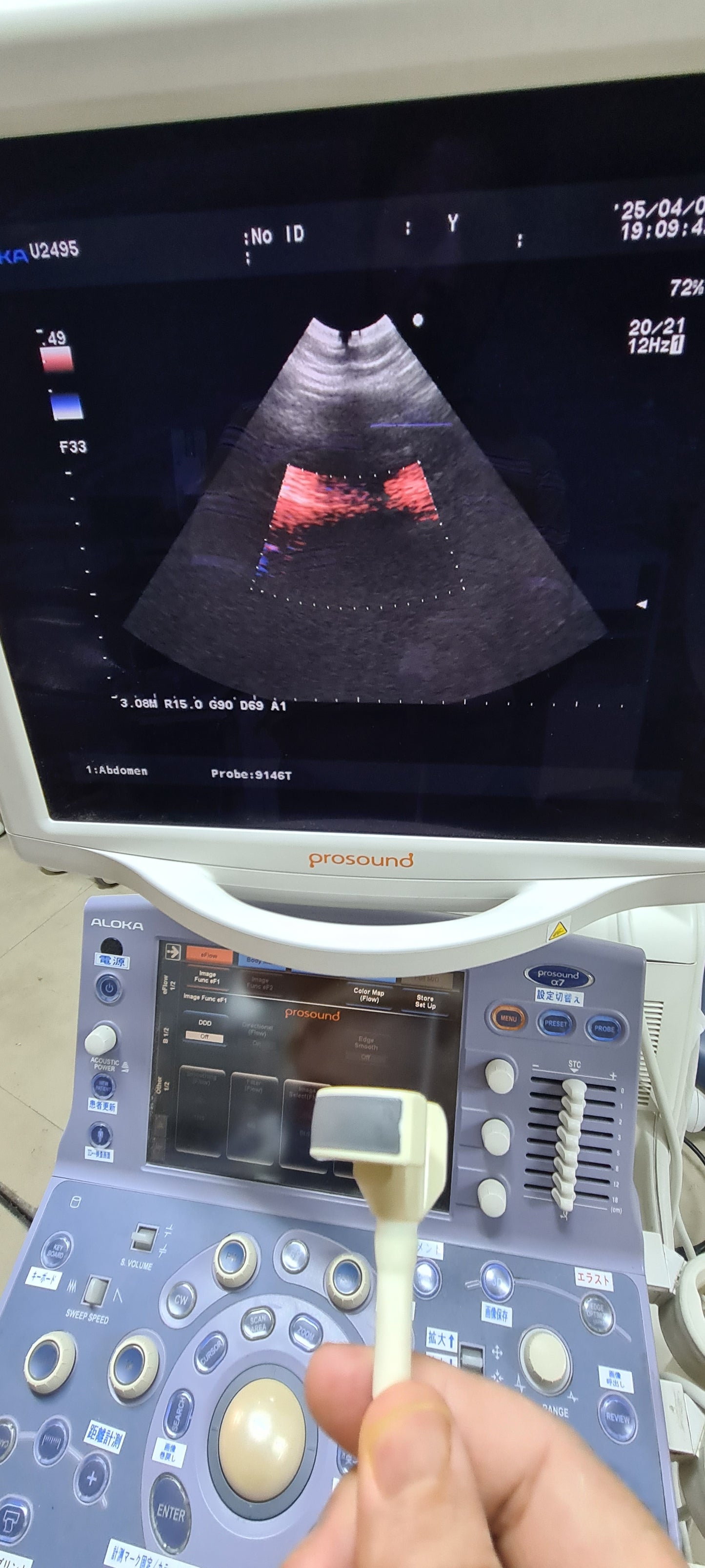 Aloka UST-9146T Micro Convex checked Av SN.20050115