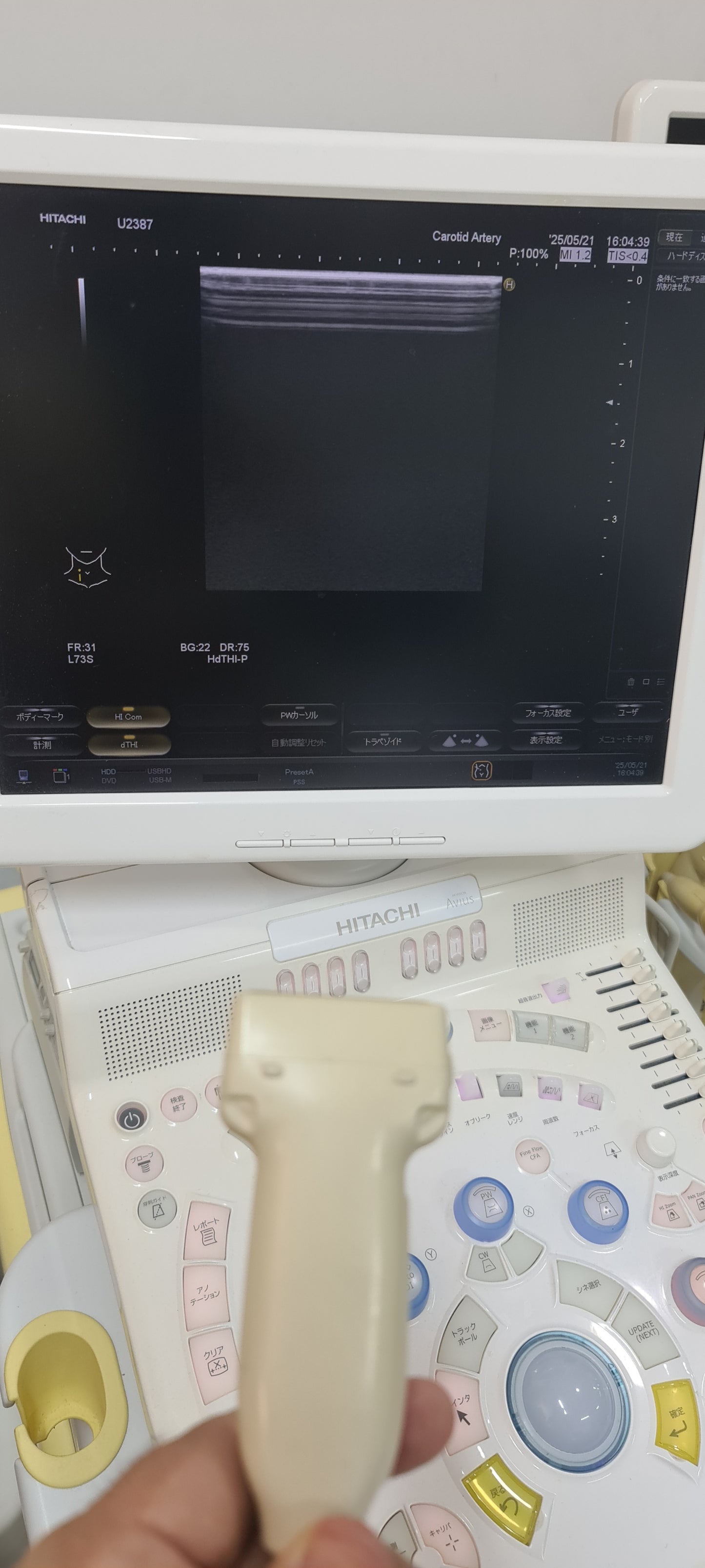 ..Hitachi EUP-L73S linear probe Checked