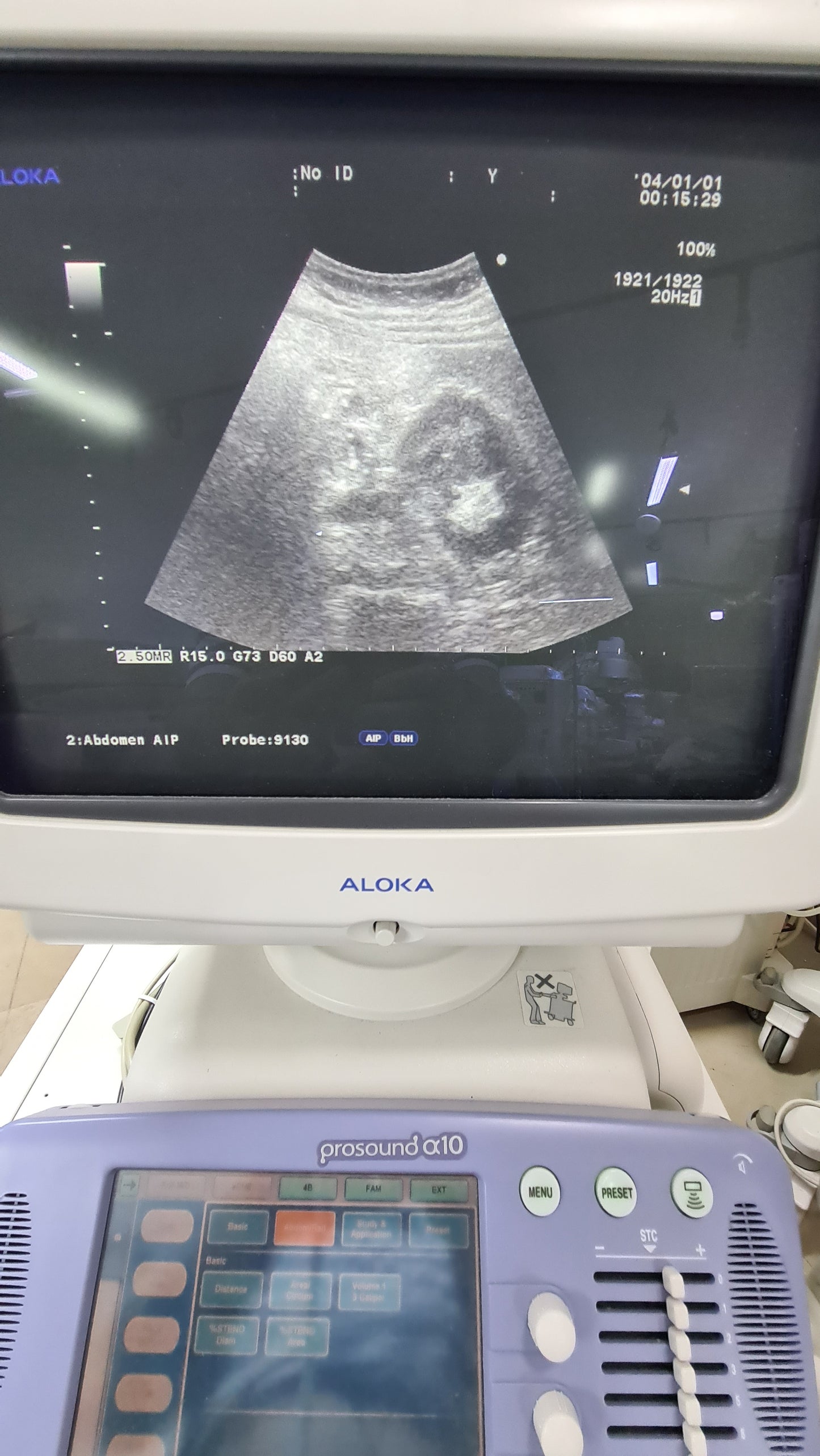 ..Aloka UST-9130 convex probe (S.N: M02904) checked DXB