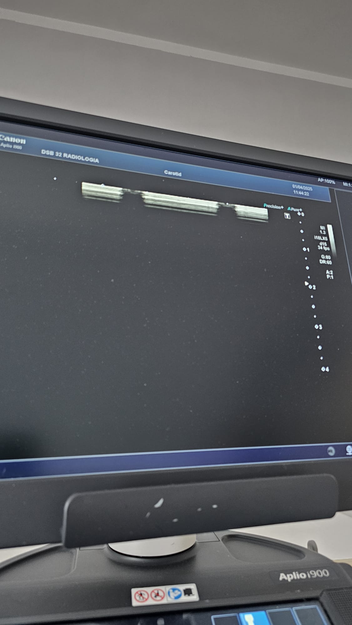 Canon i18LX5 model: PLI-1205BX Linear array transducer Mfg: 01-2018 UC