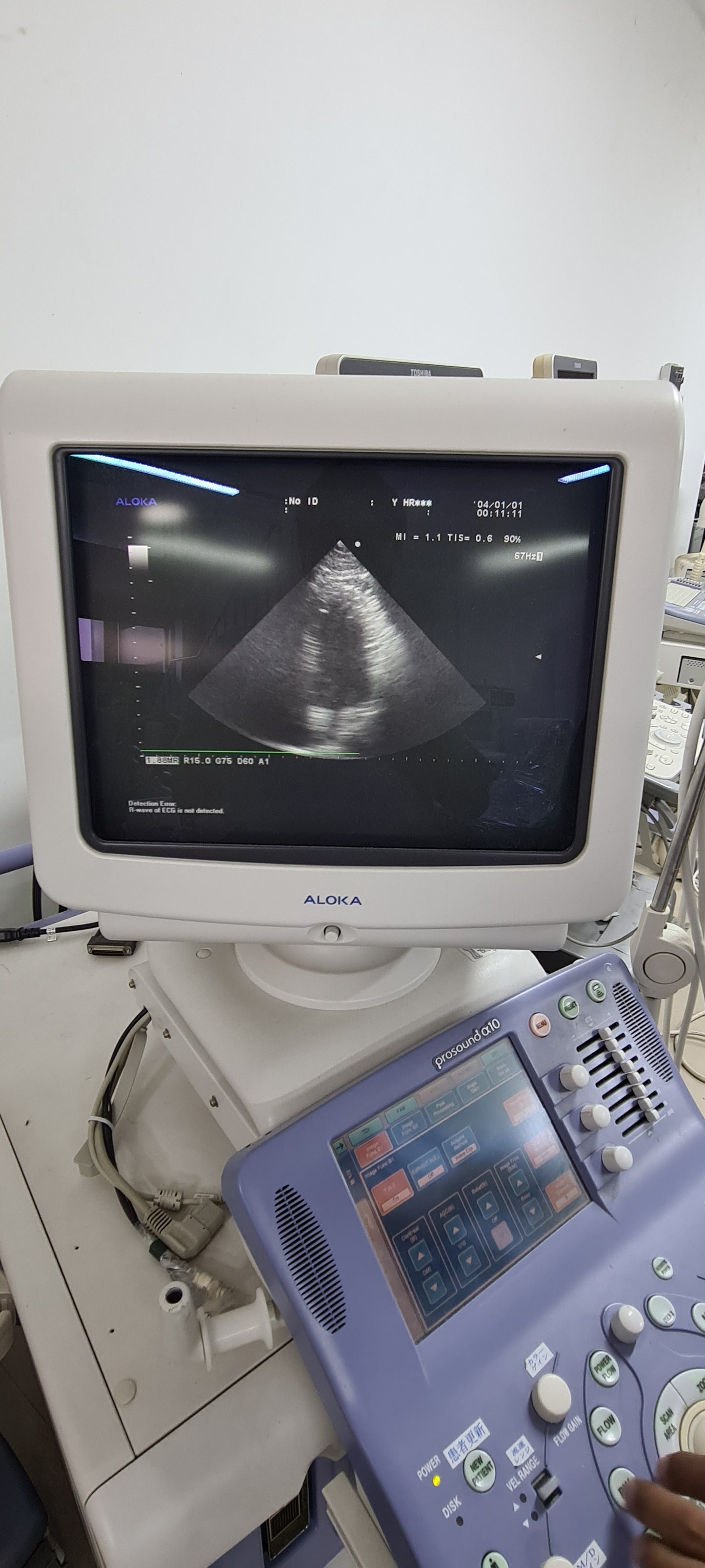 Aloka UST-52105 Cardiac prob checked SN:M01955