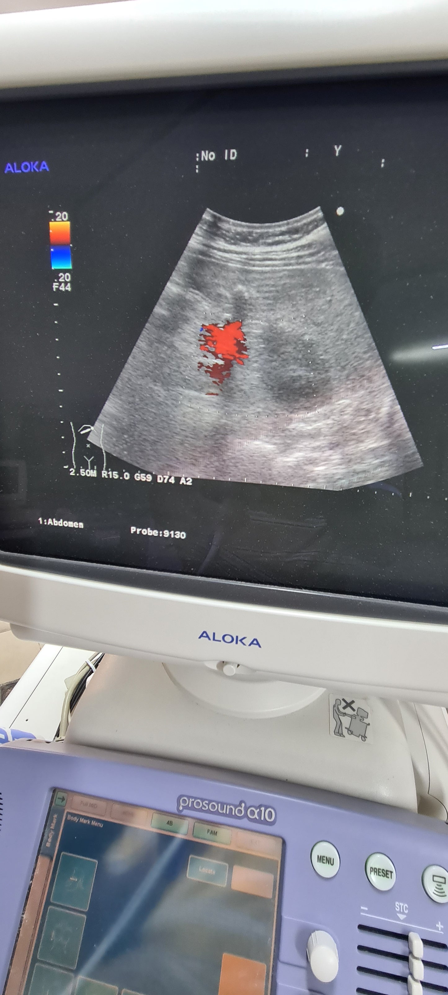 Aloka UST-9130 CONVEX checked Av. SN. X0061338
