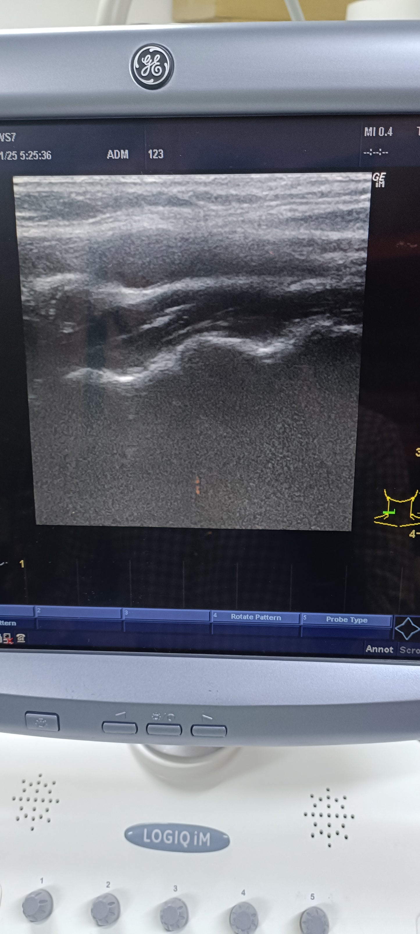 Ge 11L linear probe sn. 150711WP0 CHECKED OK DXB