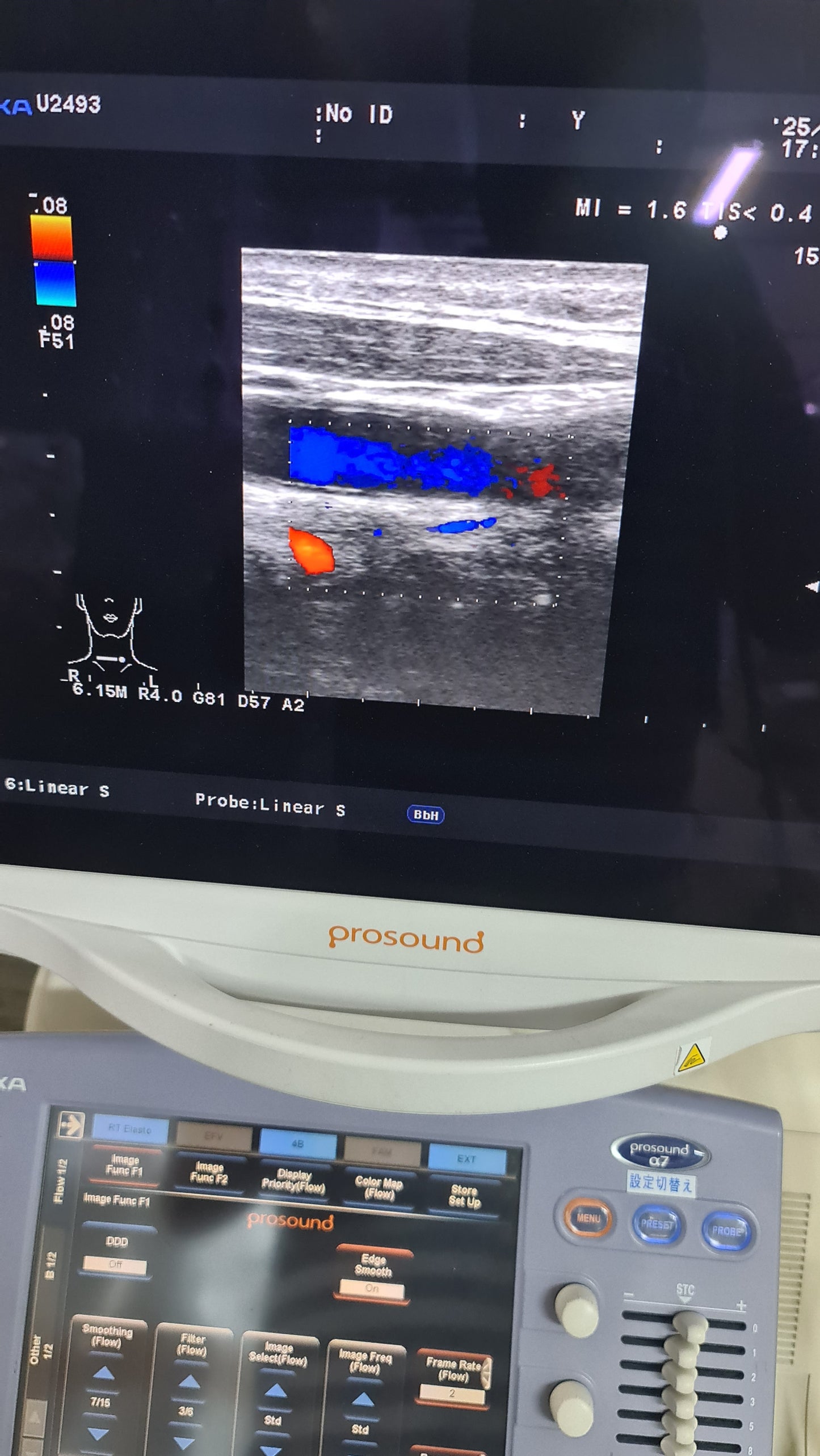 Aloka UST-5412 liner prob SN. M02414 checked