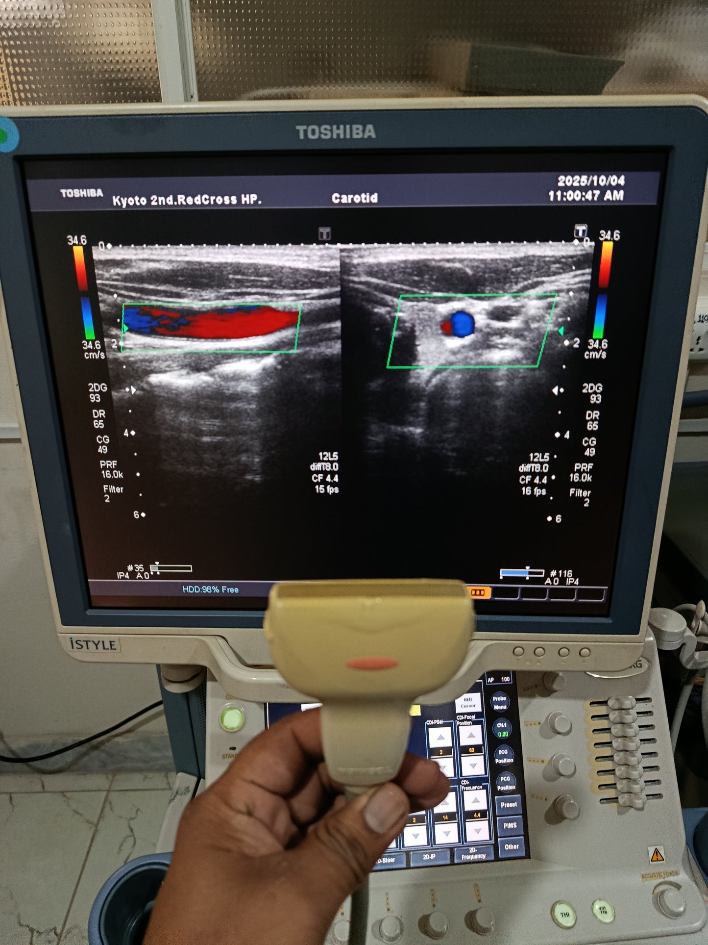 P..Toshiba PLT-805AT Linear Probe
