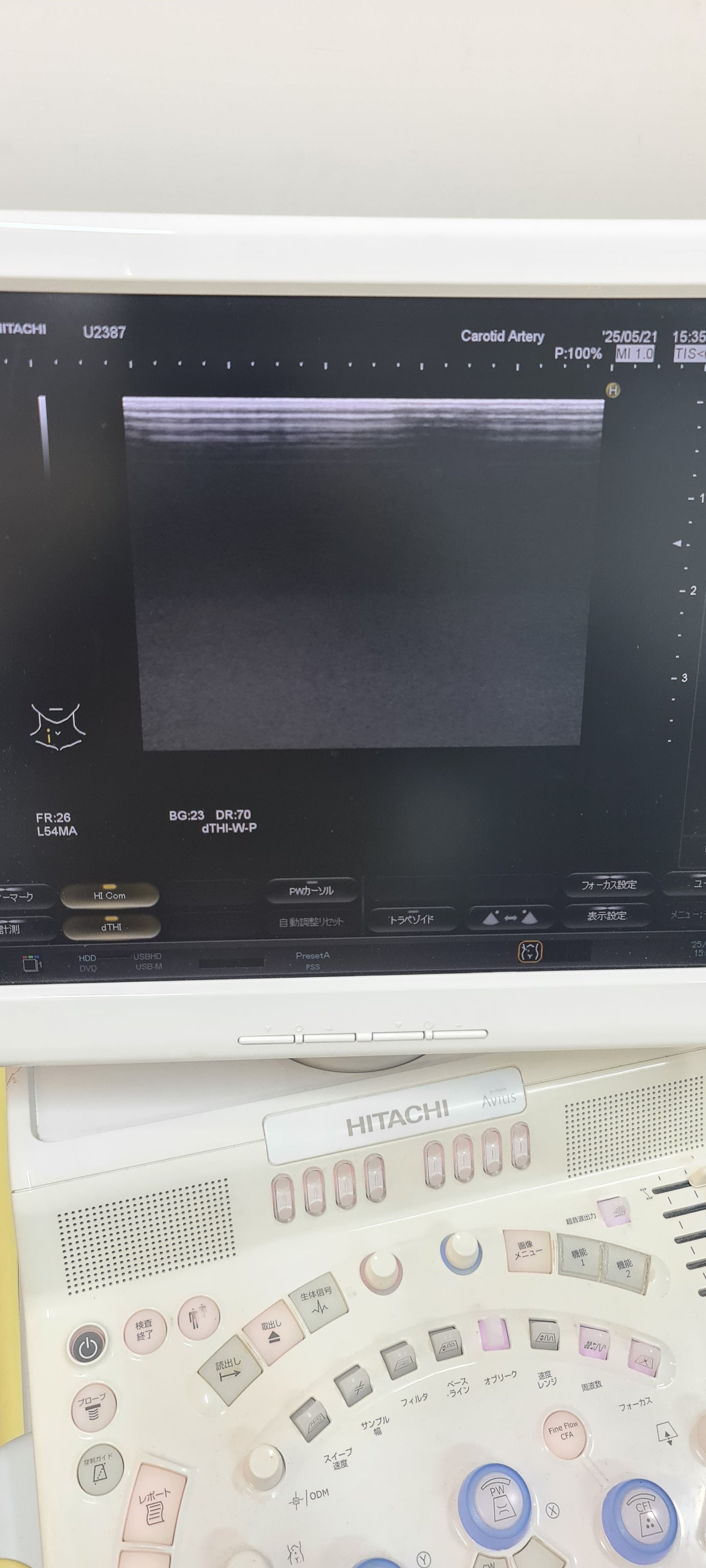 ..Hitachi EUP-L54MA linear probe Checked