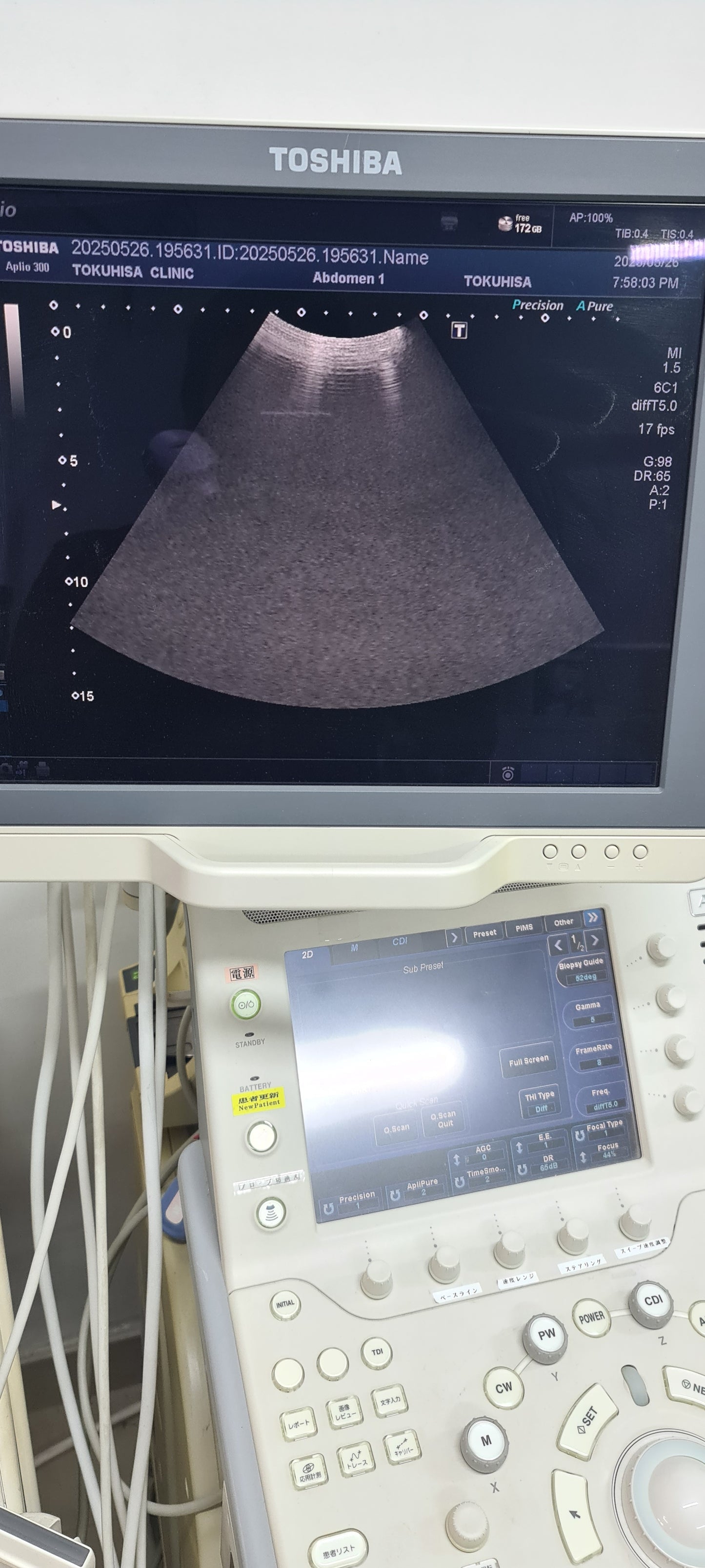..Toshiba PVT-375BT convex probe SN: FSC2113099