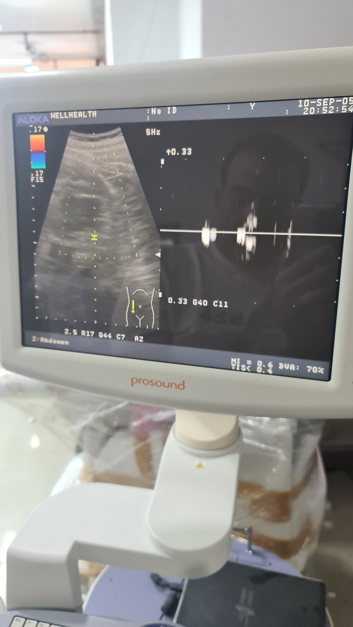 Z..Aloka UST-9123 Convex Probe checked SN V0002986