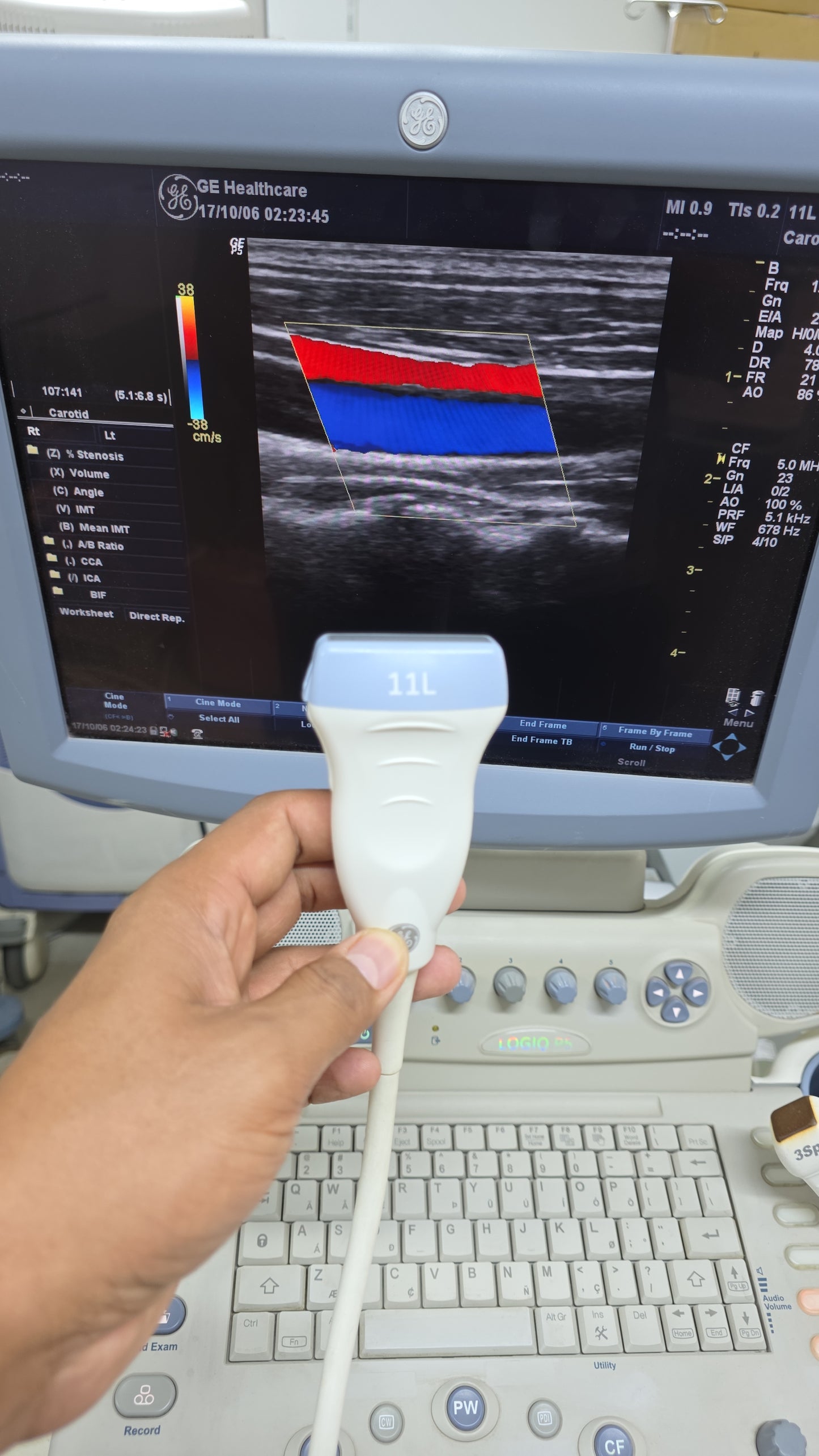 GE 11L Linear probe for logiq p5,p6 mfg: 2014