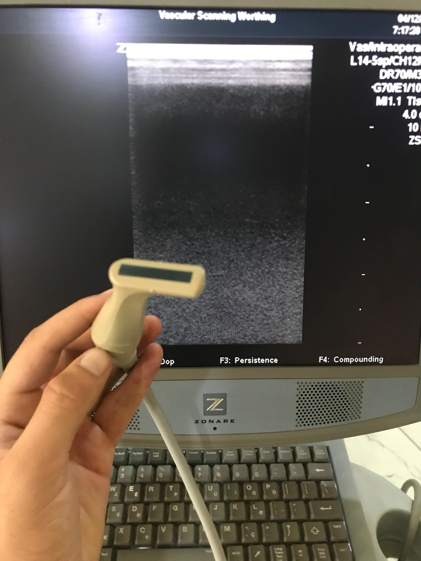 ..Fujifilm L14-5sp linear array probe