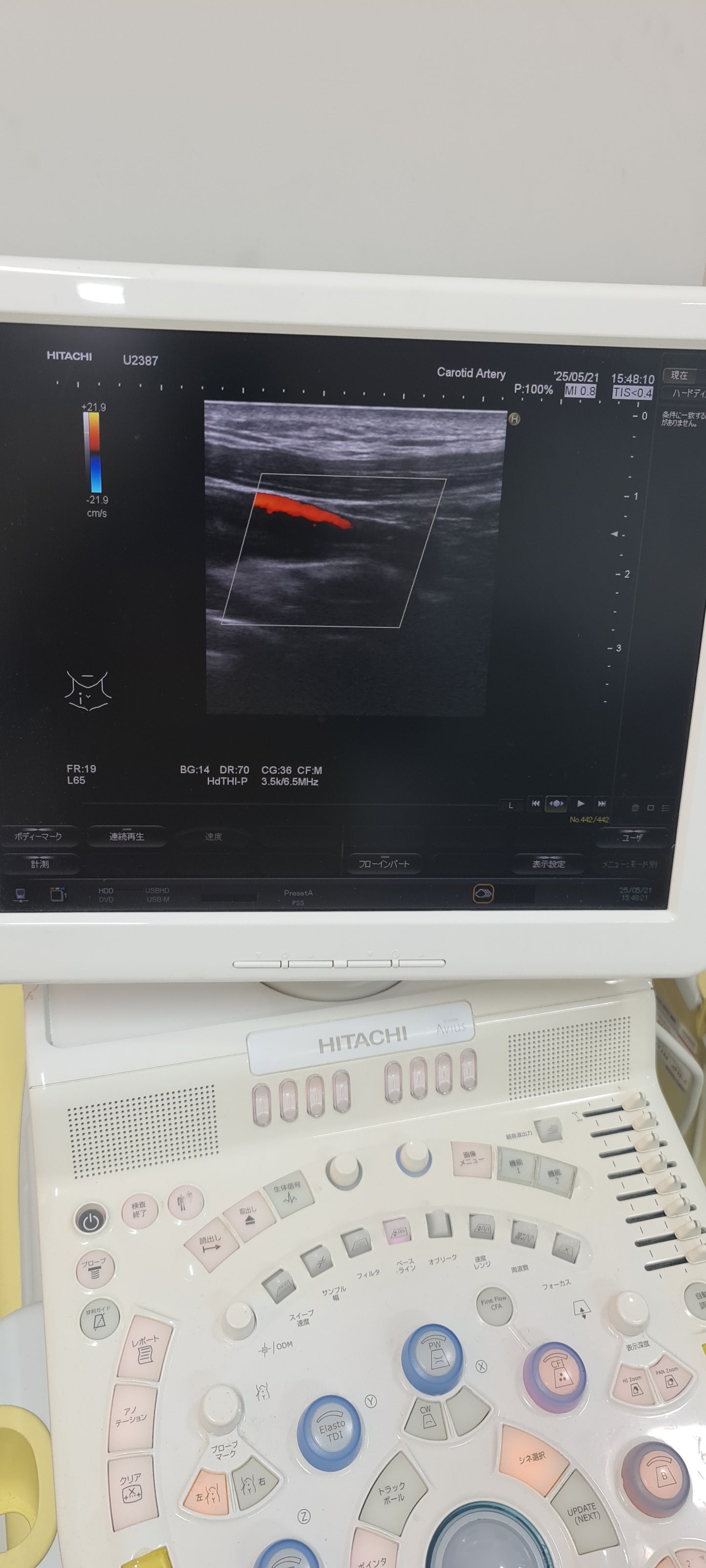 ..Hitachi EUP-L64 linear probe Checked DXB - Japan Medical Company LTD