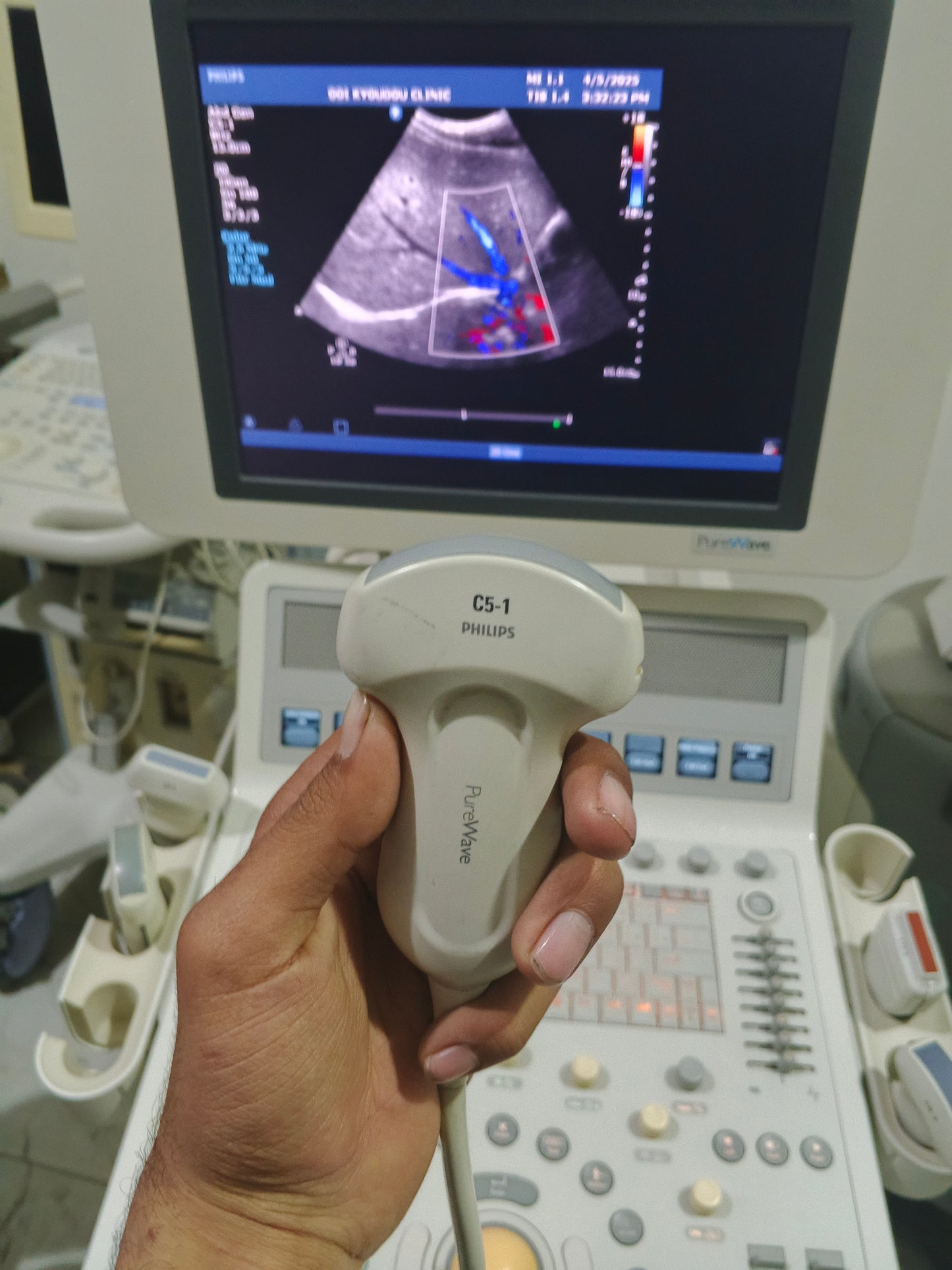 P...Philips C5-1 Convex Probe