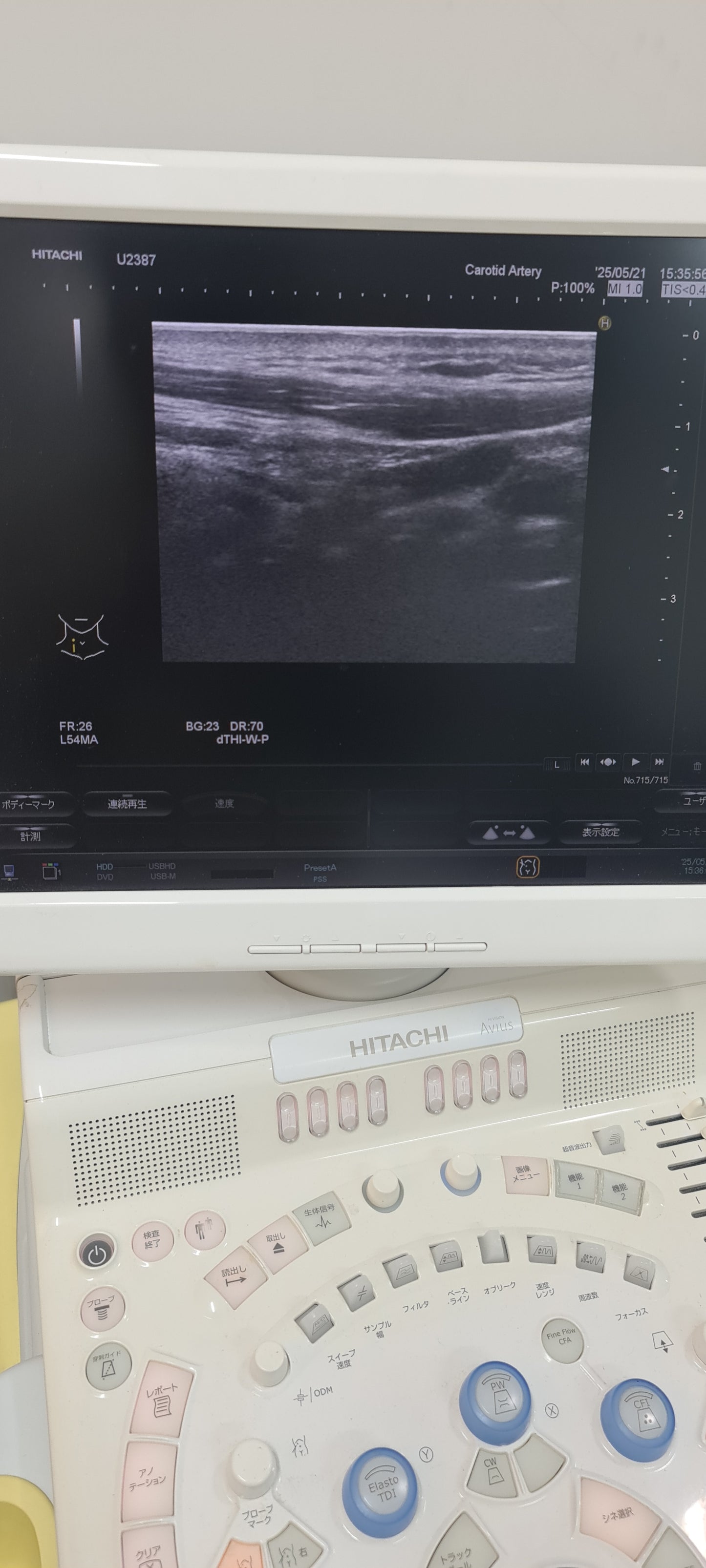 ..Hitachi EUP-L54MA linear probe Checked