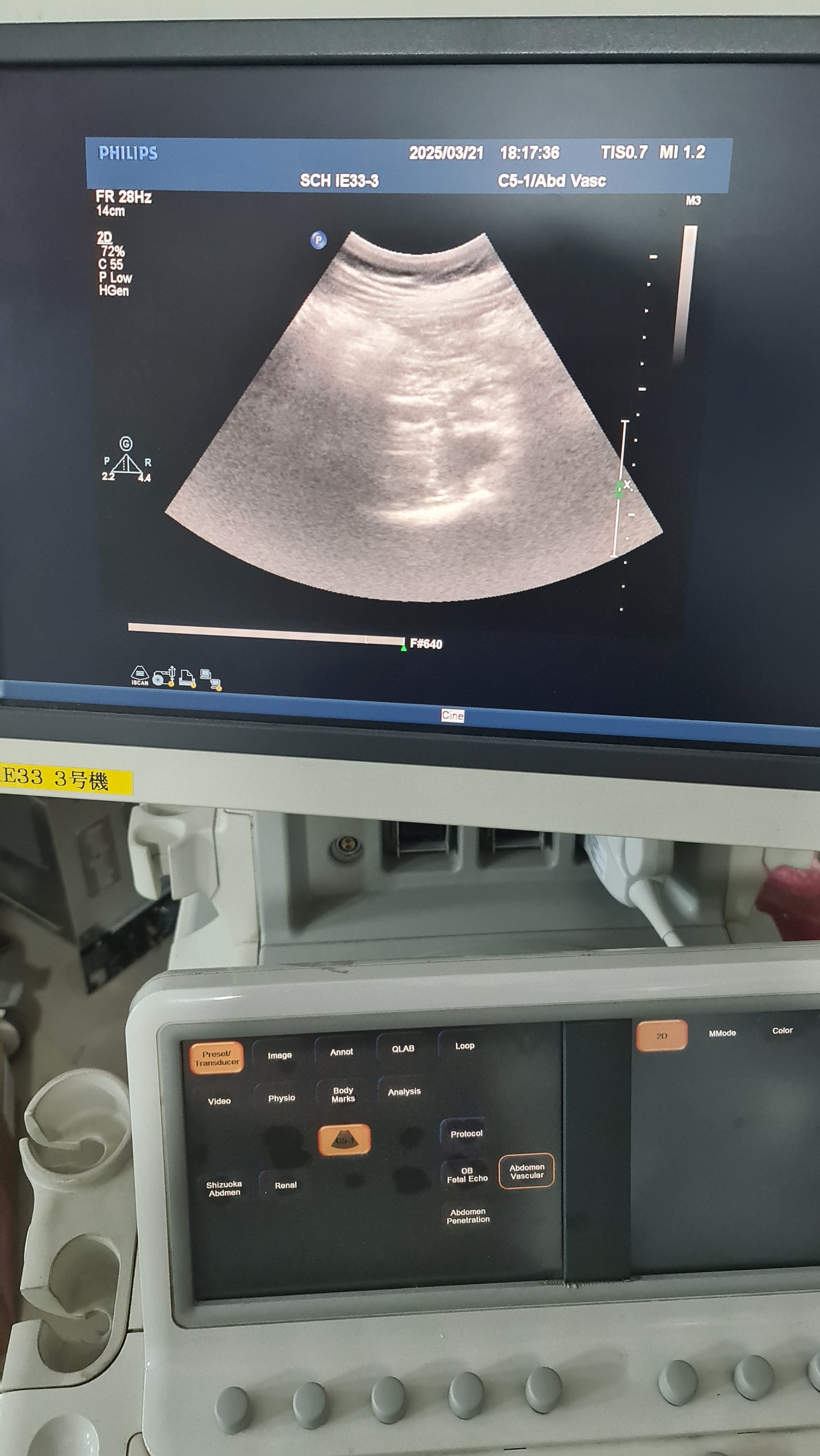 ...Philips C5-1 Convex Probe Checked DXB