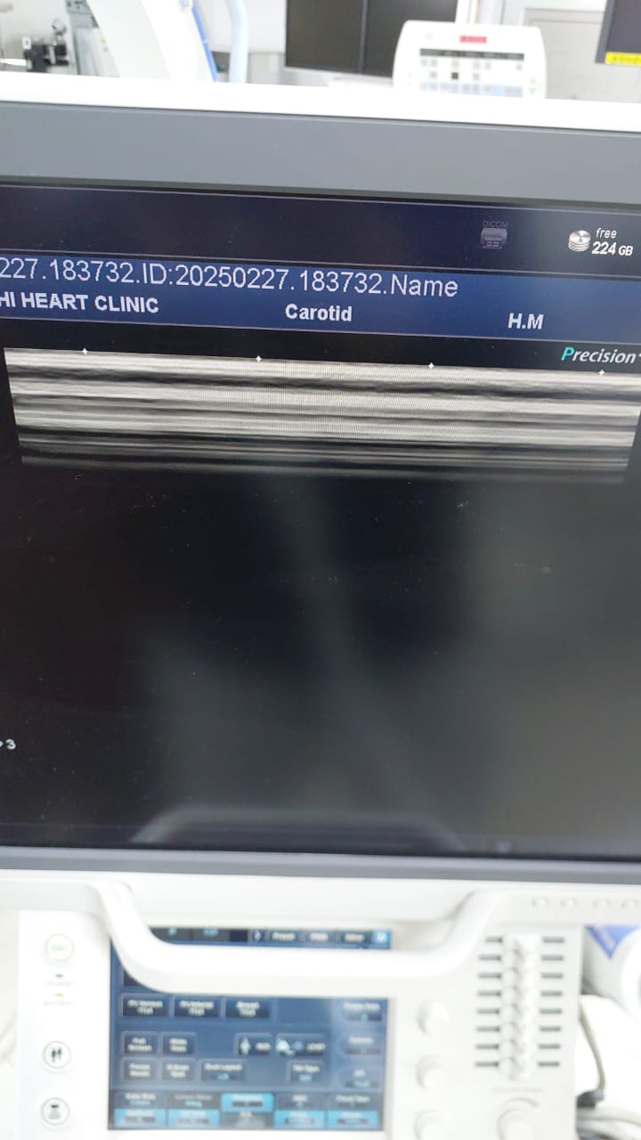 Toshiba Canon PLU-704BT 11L4, Linear array probe Mfg: 2013