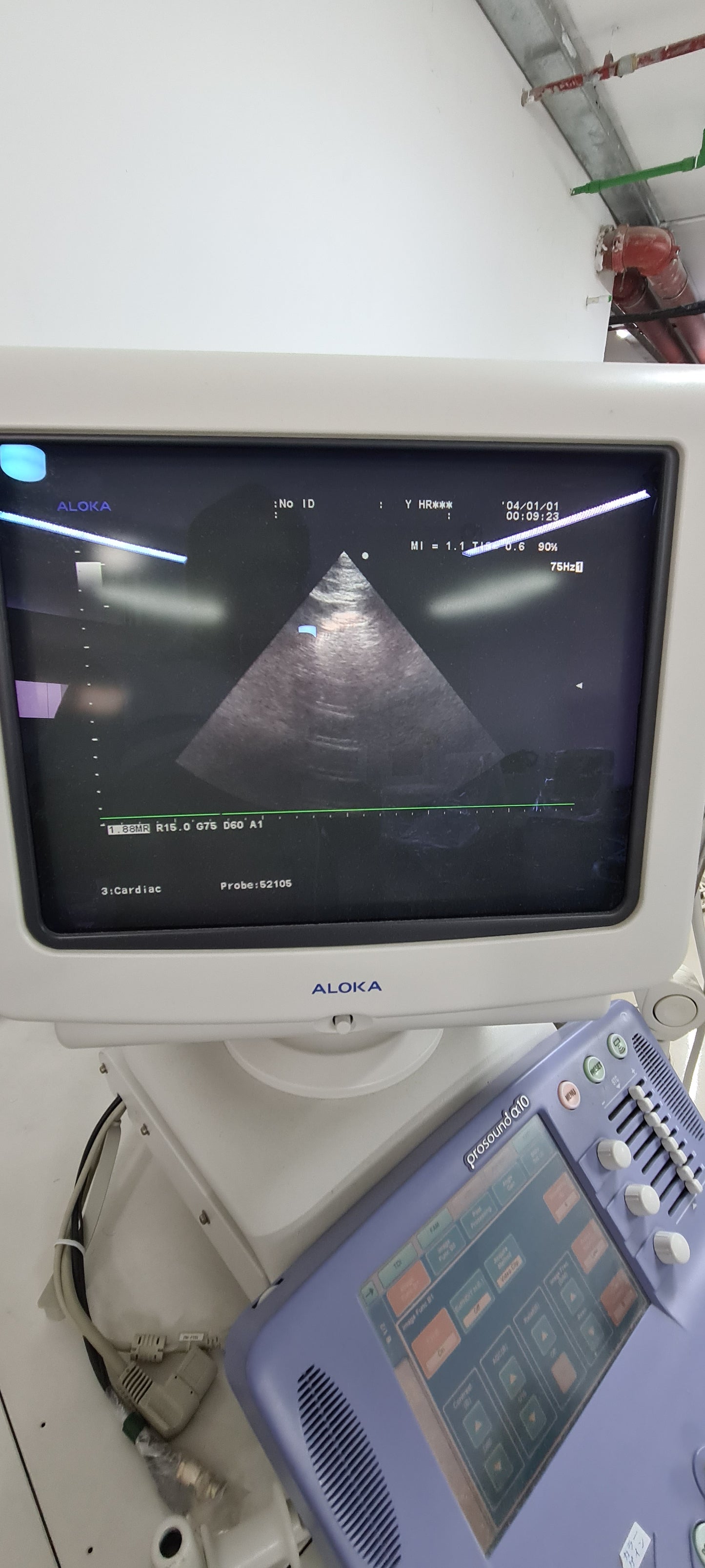 Aloka UST-52105 Cardiac prob checked SN:M01955