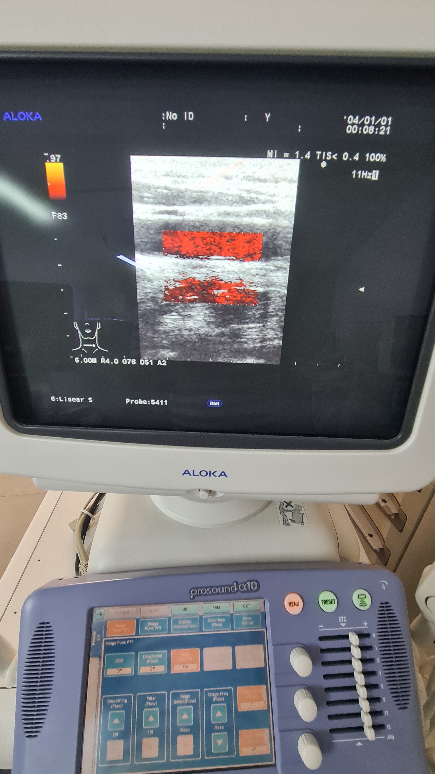 Aloka UST-5411 PROB L SN. M00355 checked