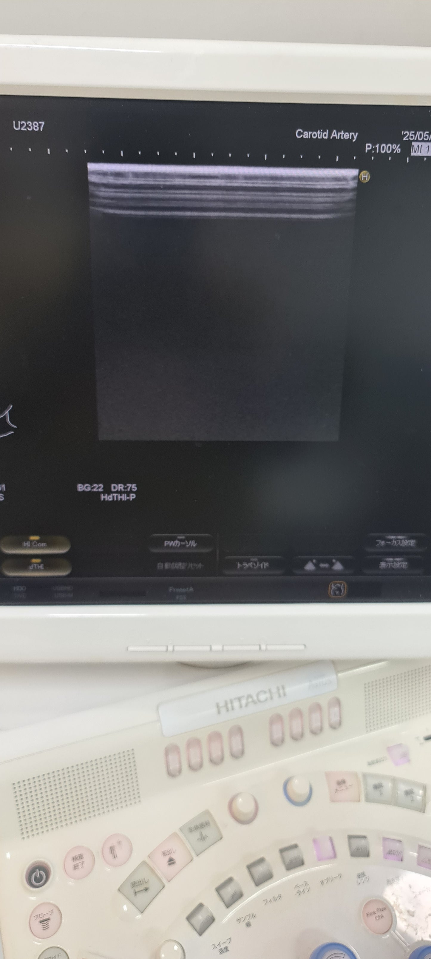 ..Hitachi EUP-L73S linear probe Checked