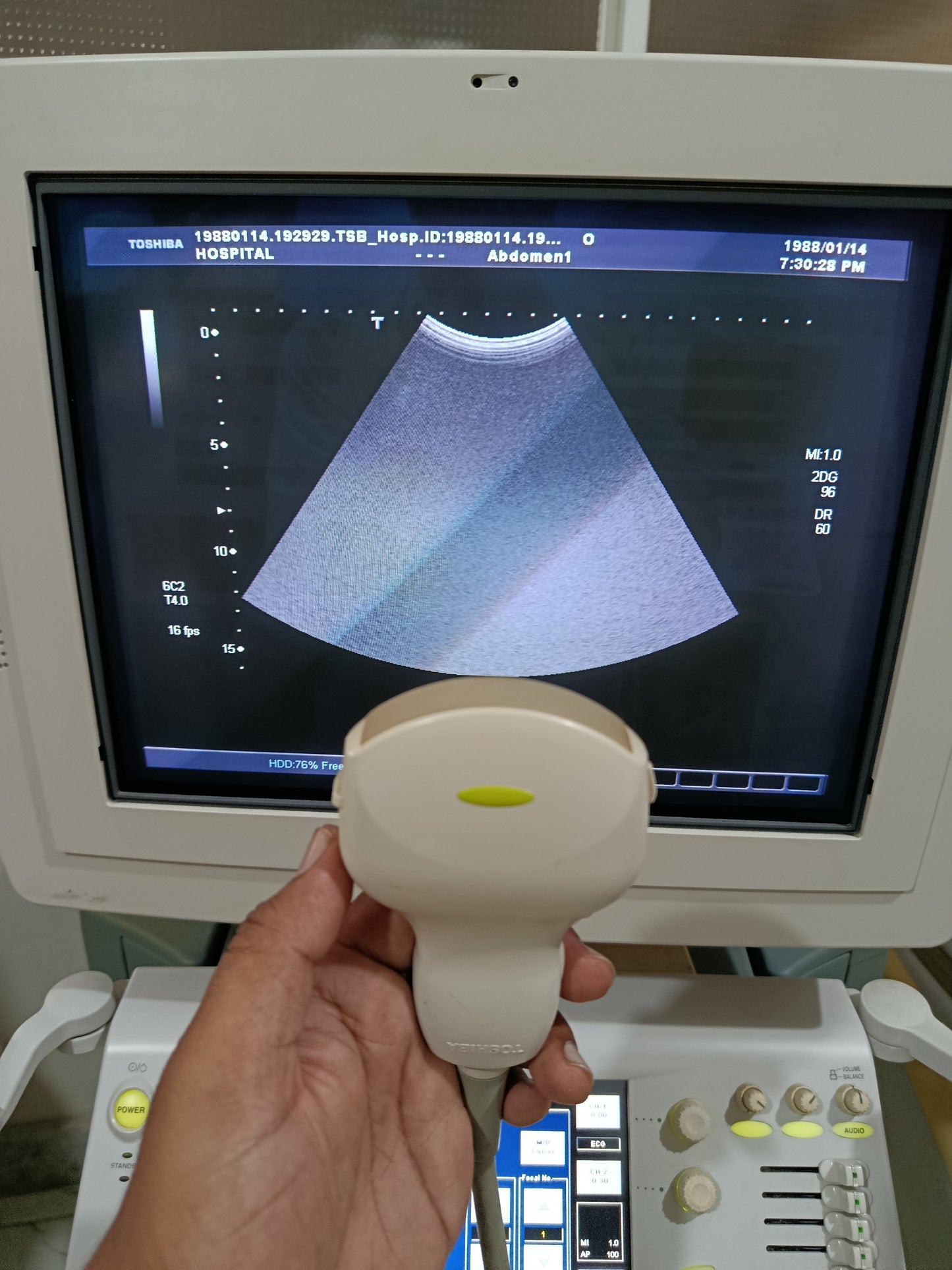 P.. Toshiba PVT-375AT Convex Probe