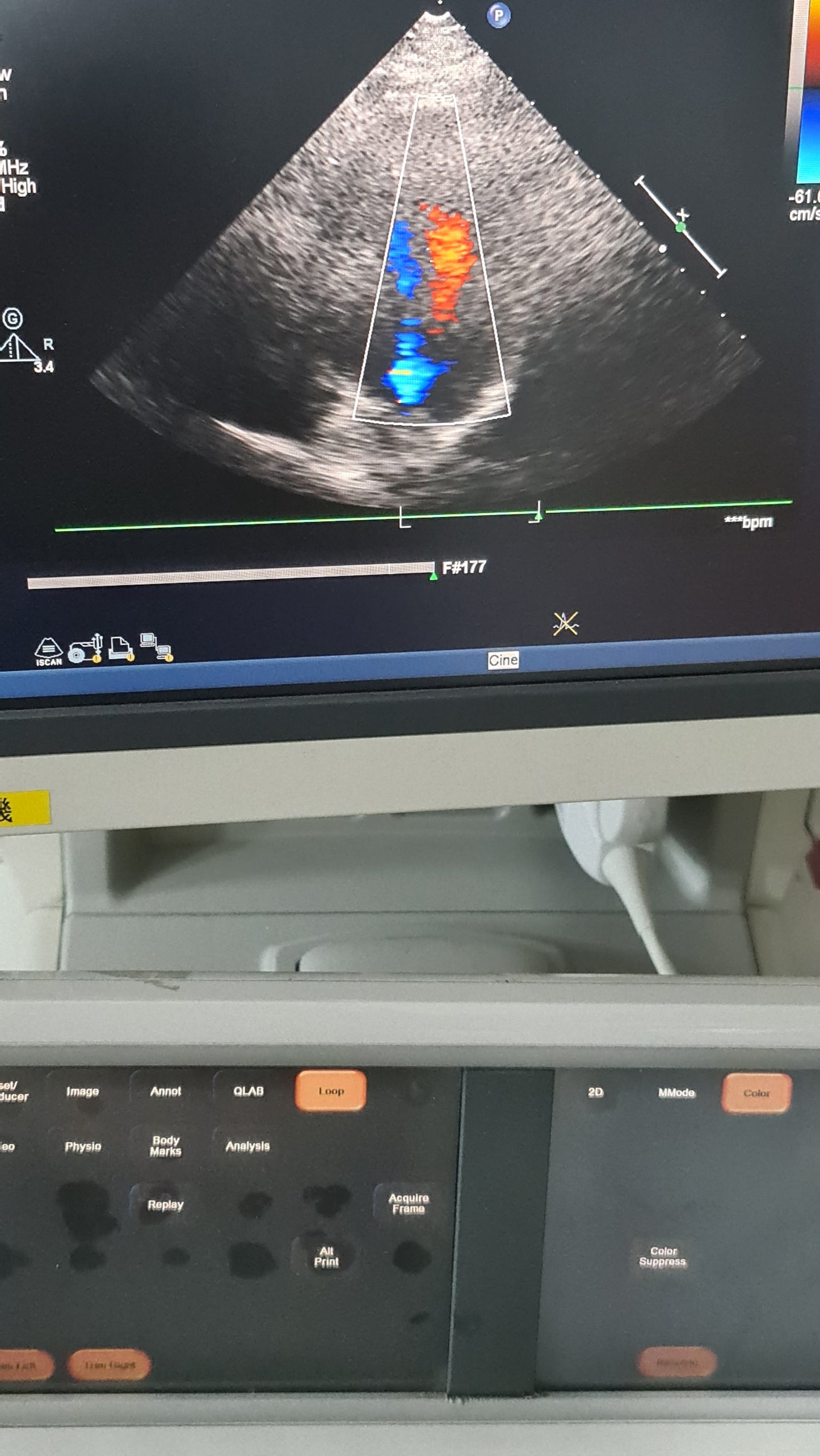 S5-1 philips prob cardiac