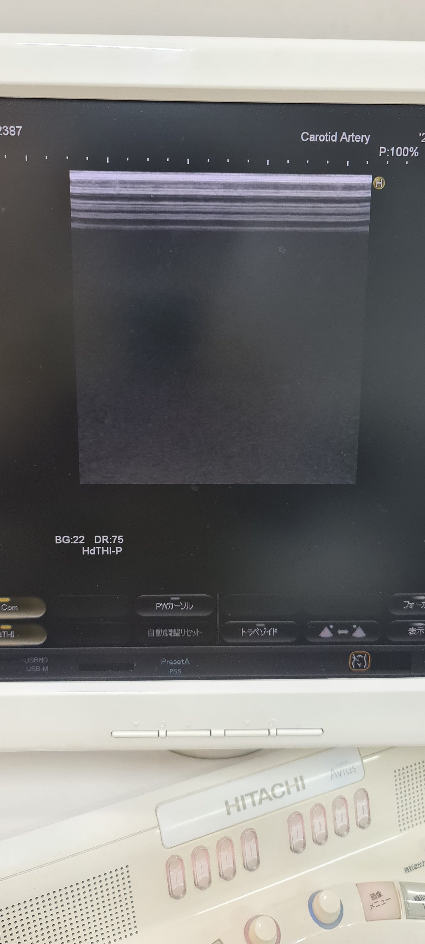 ..Hitachi EUP-L73S linear probe Checked DXB