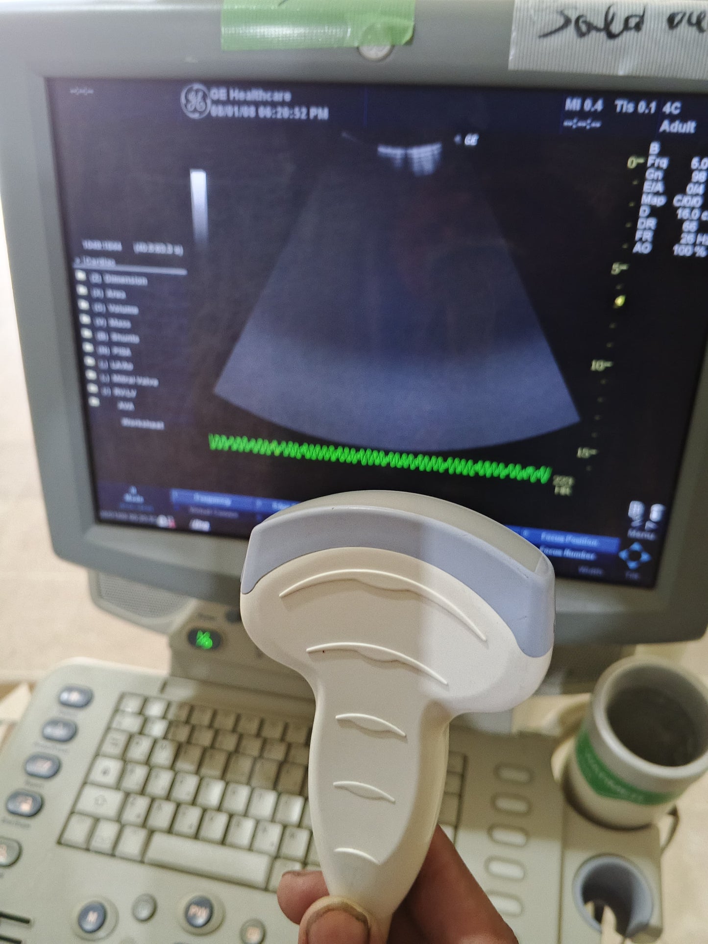 GE logiq p5 Convex probe