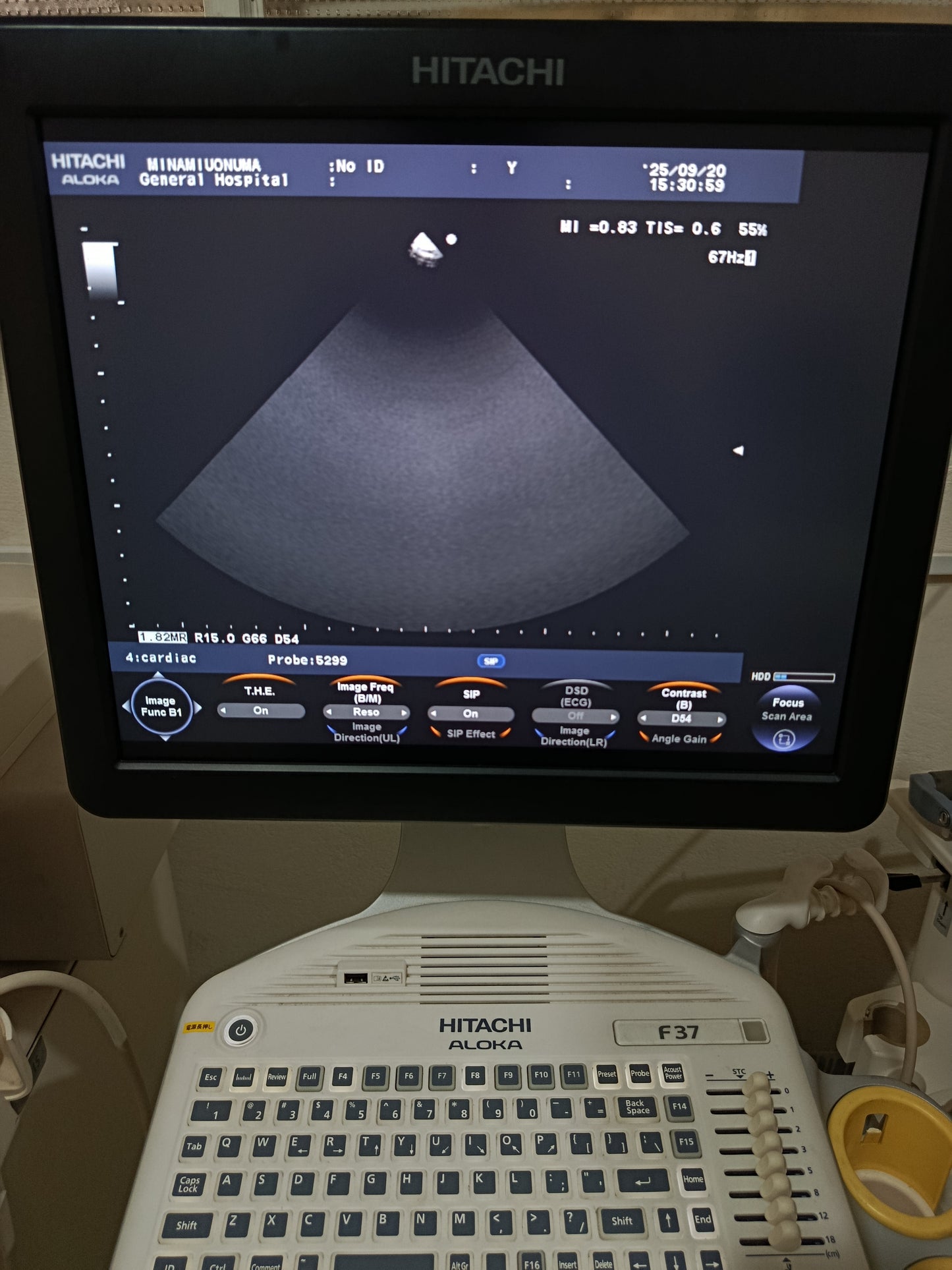 P…Aloka UST-5299 cardiac UCprobe