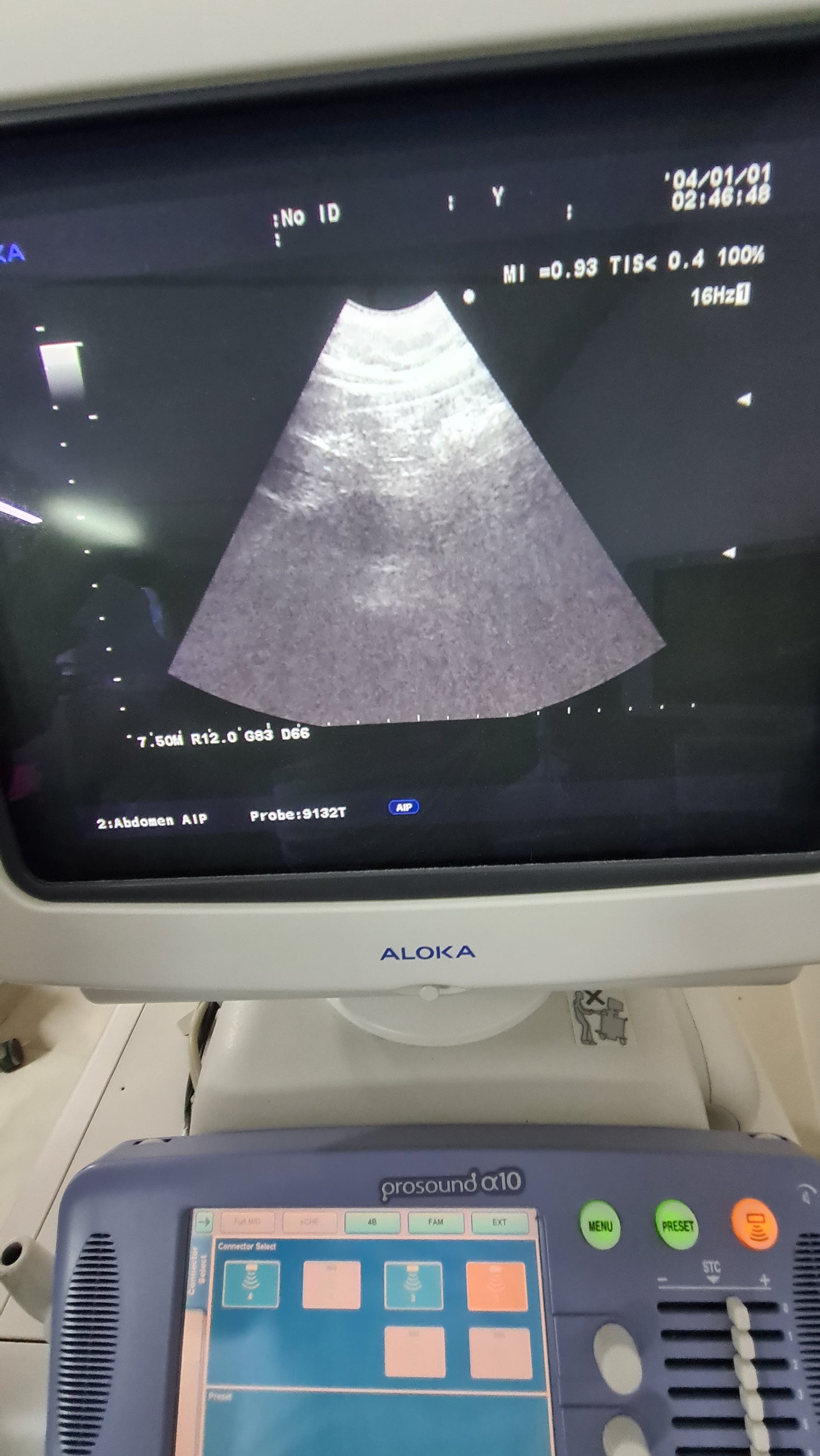 Aloka UST-9132T SN. 203D1550 checked dxb
