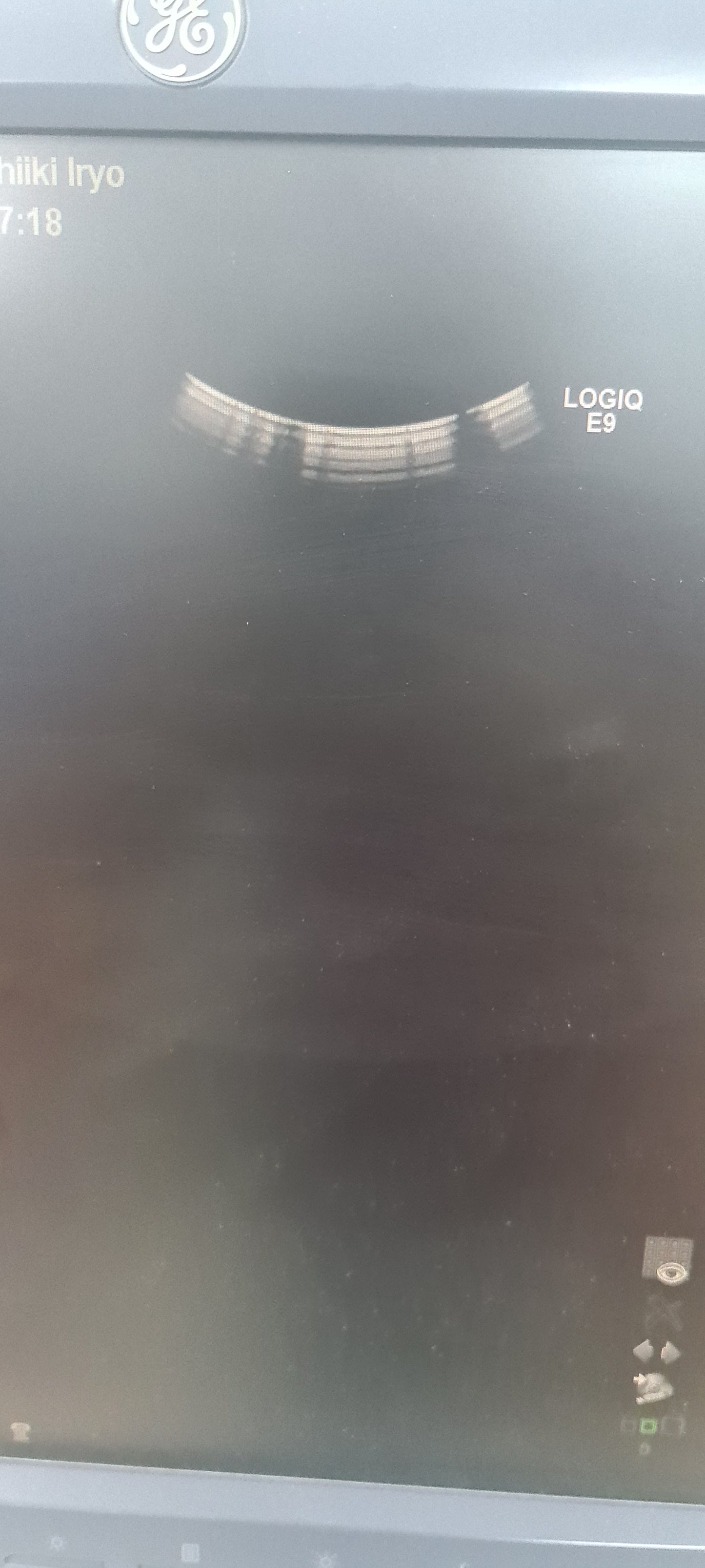 EGT Ge C1-5 Convex prob SN: EGT-C1500