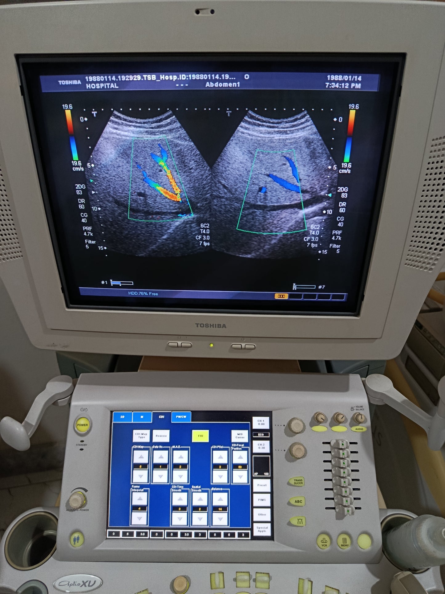 P.. Toshiba PVT-375AT Convex Probe