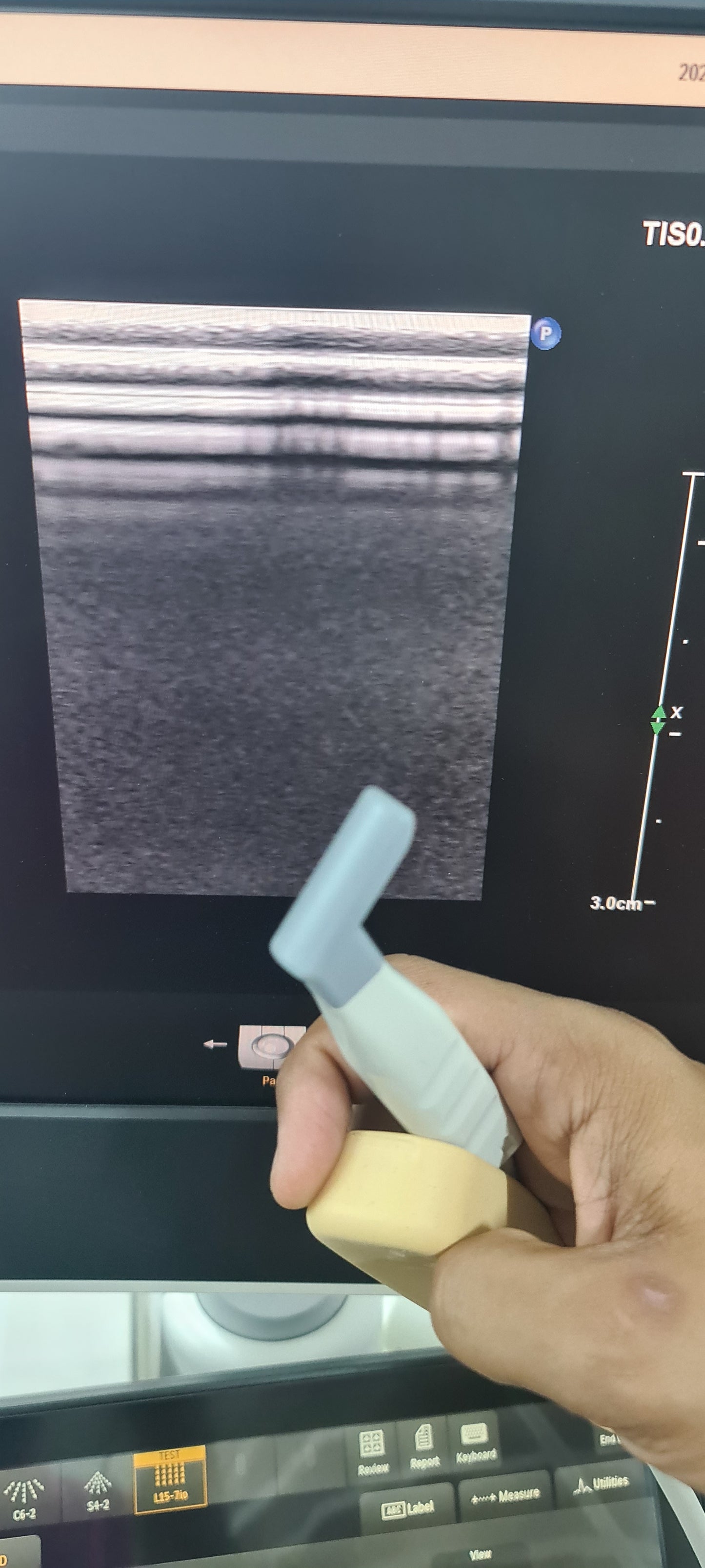 Philips L15-7io Hockey stick Prob SN: B0K8N4 checked DXB