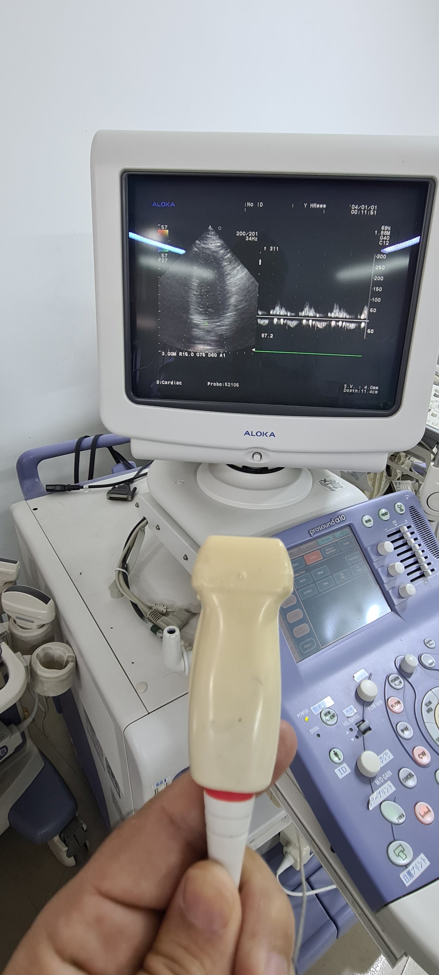 Aloka UST-52105 Cardiac prob checked SN:M01955