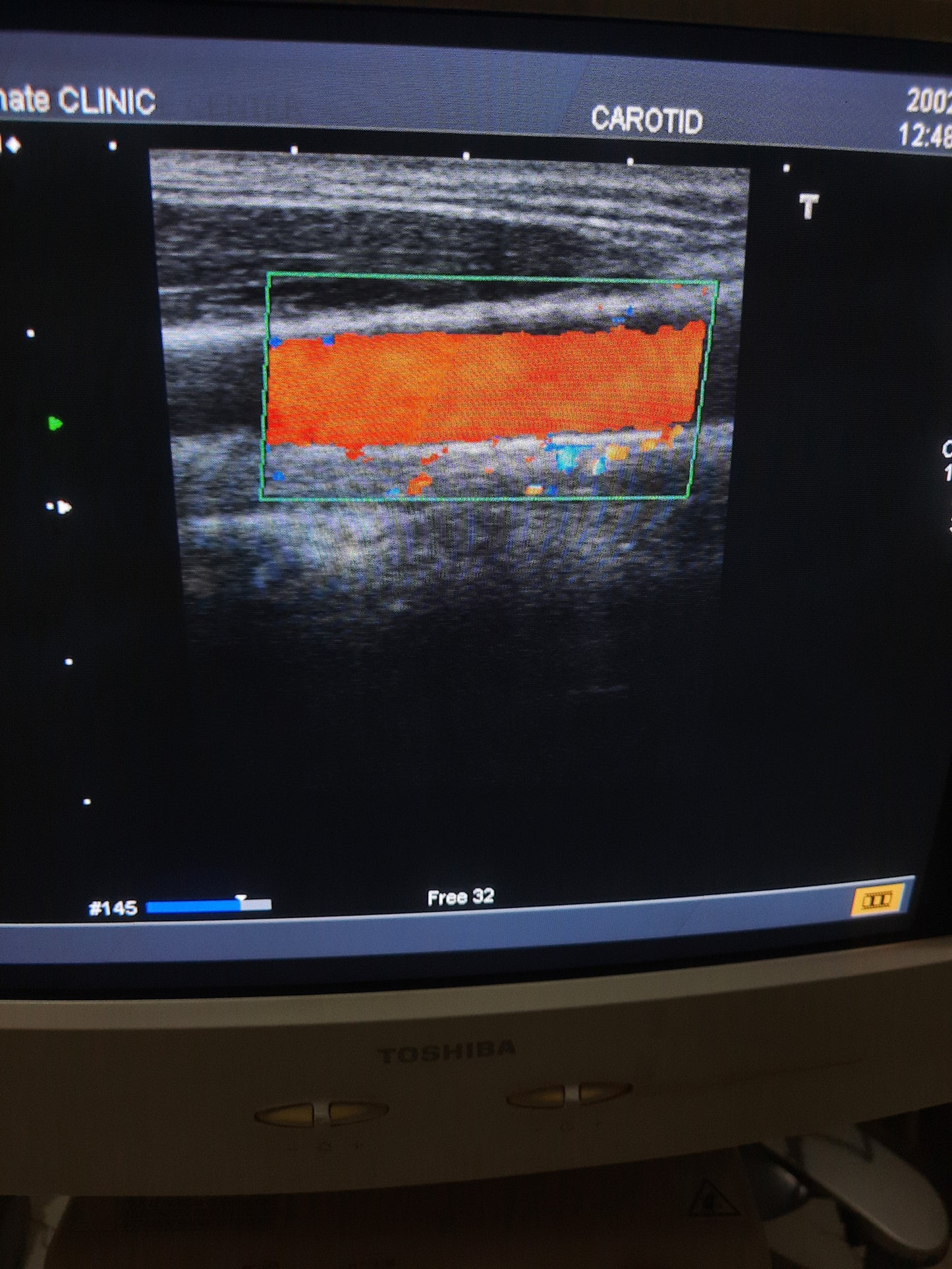 Toshiba PLM-1204AT Linear Probe