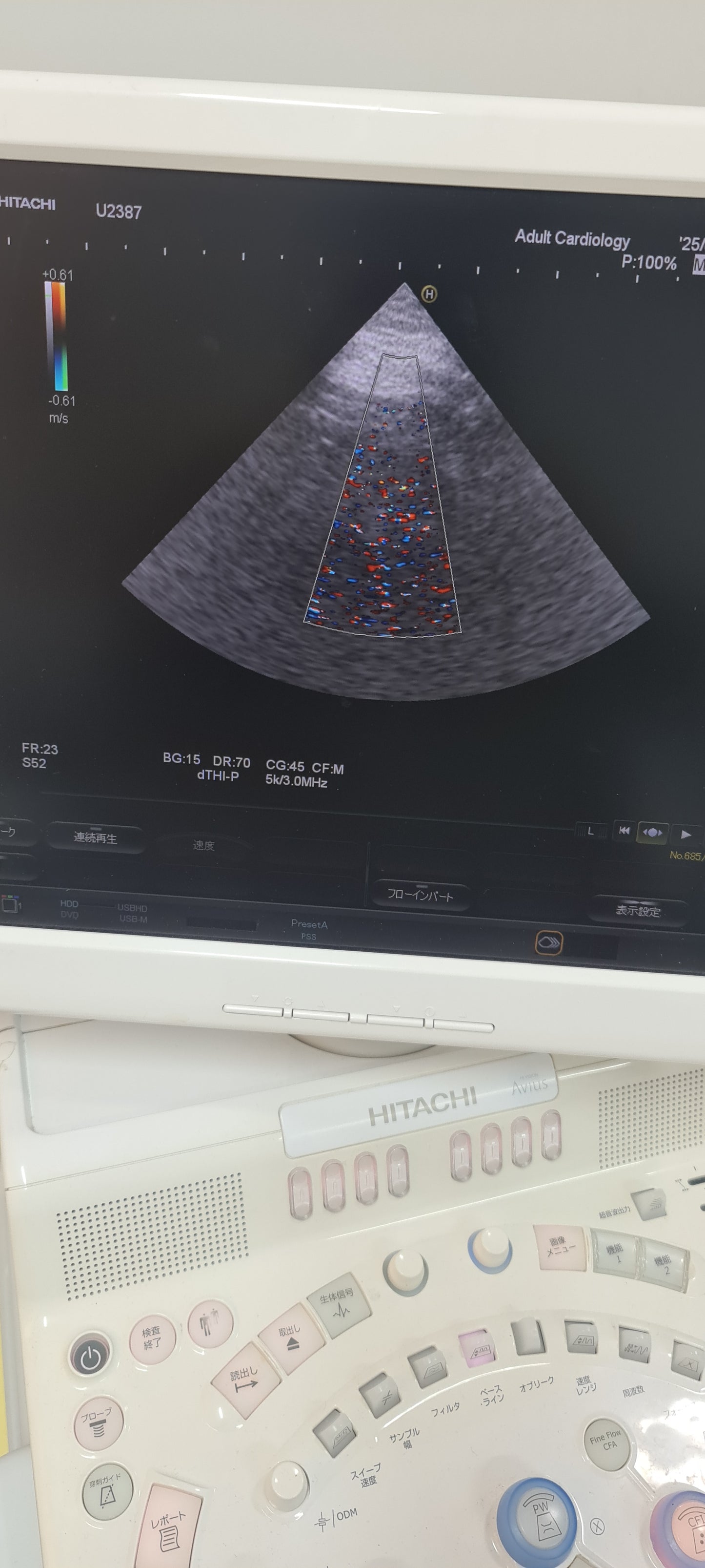 ..Hitachi EUP-S52 cardiac probe Checked DXB
