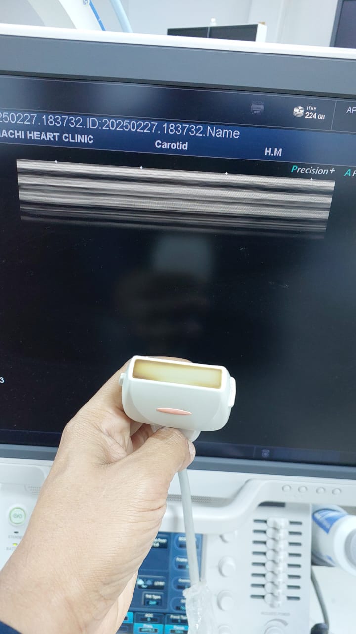 Toshiba Canon PLU-704BT 11L4, Linear array probe Mfg: 2013