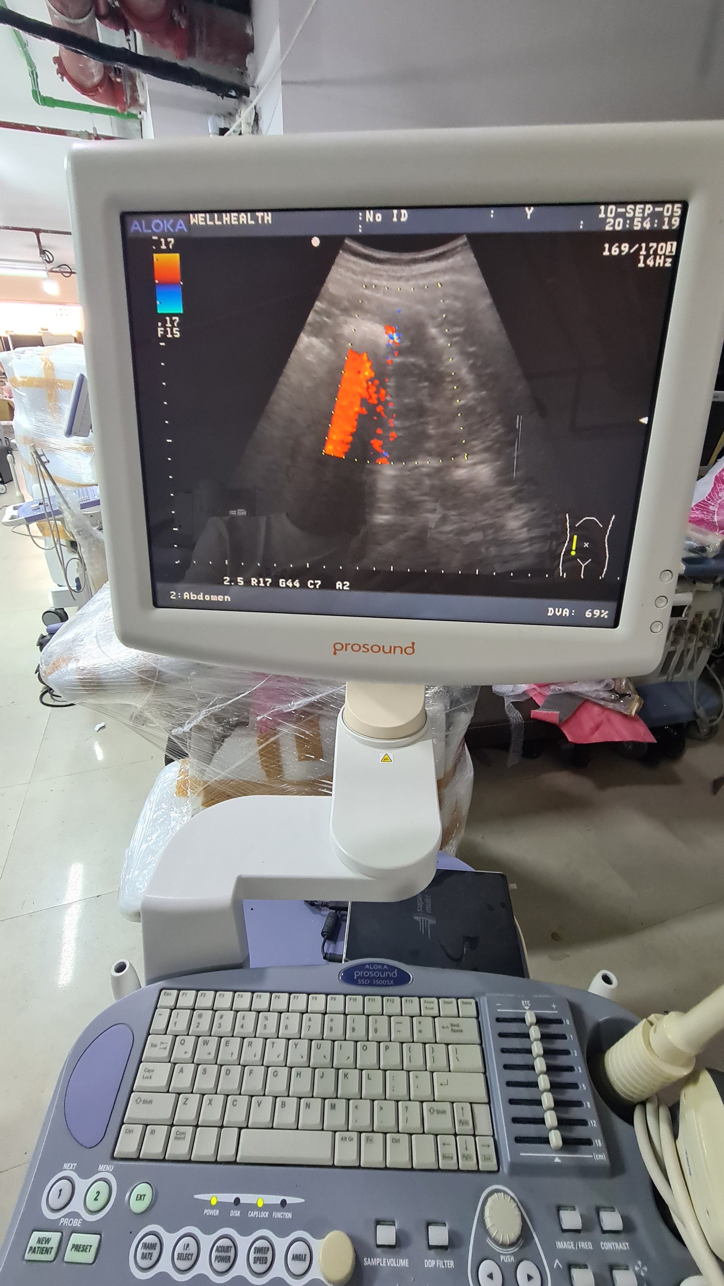 Z..Aloka UST-9123 Convex Probe checked SN V0002986