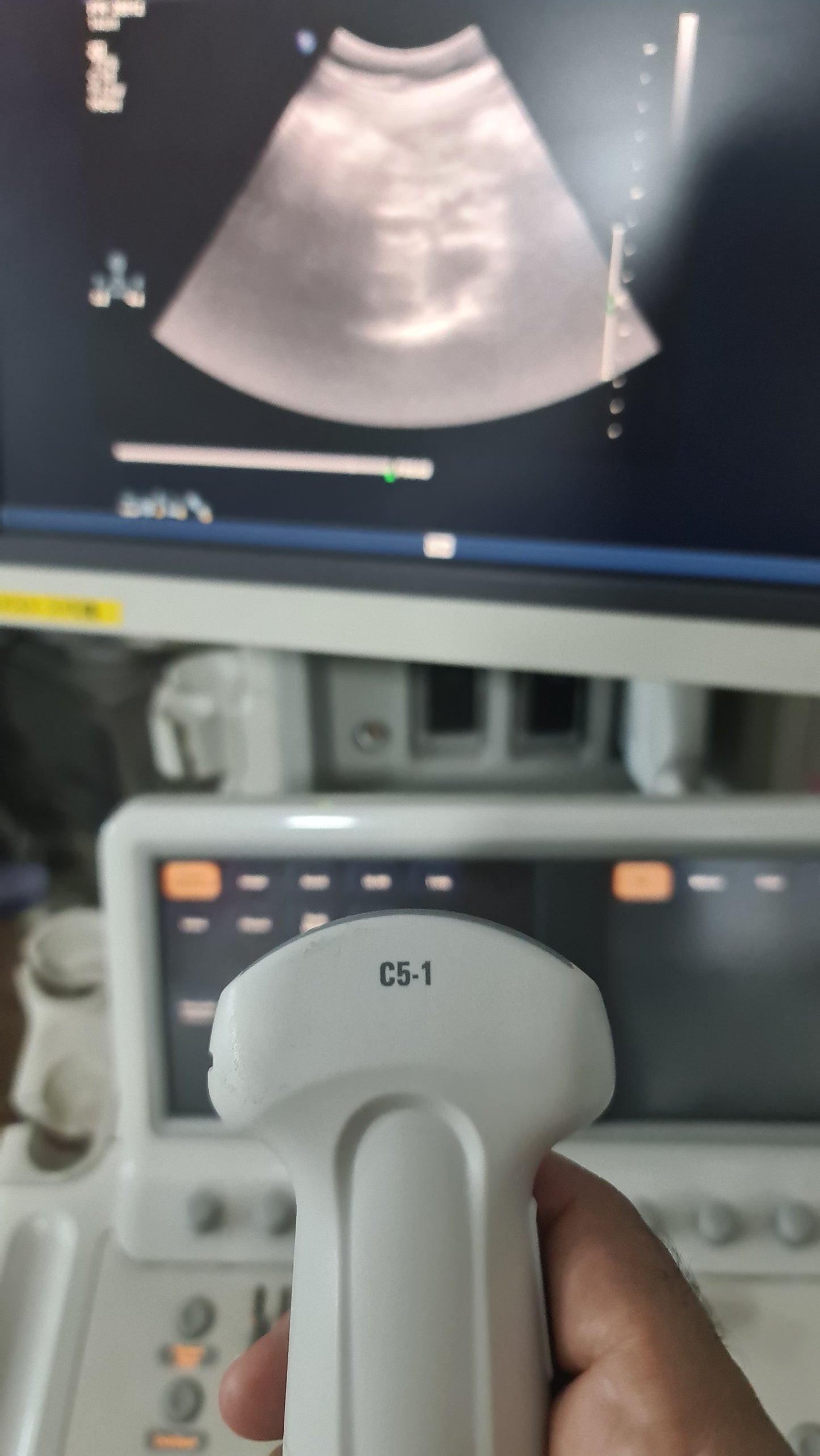 ...Philips C5-1 Convex Probe Checked DXB