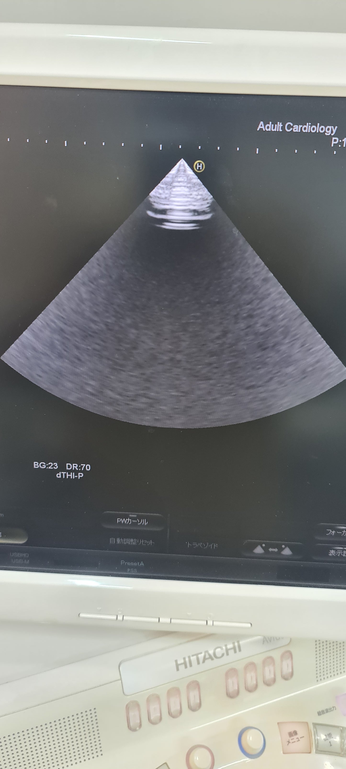 ..Hitachi EUP-S50A cardiac probe Checked DXB