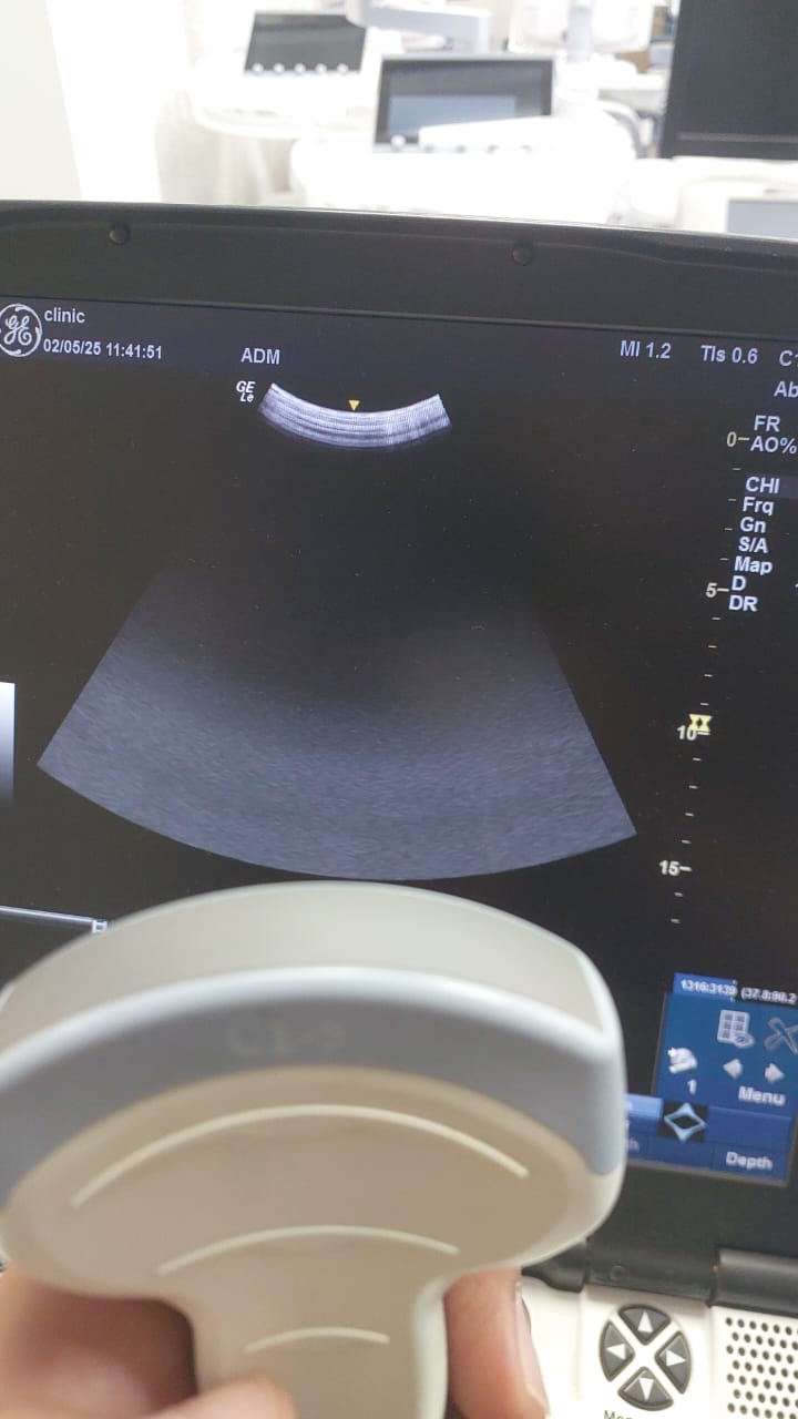 C1-5 RS Av (23) UC