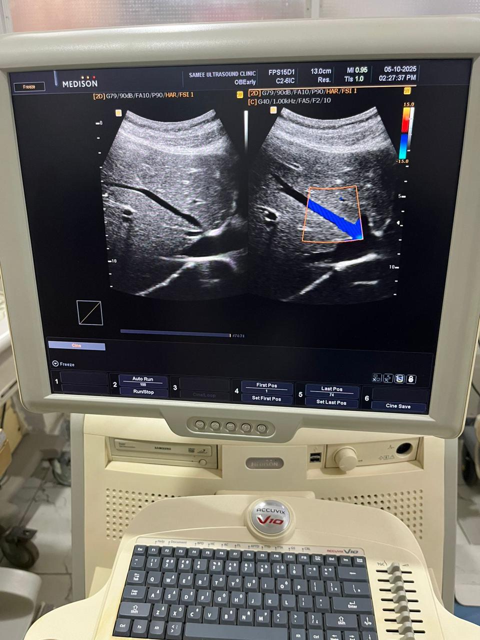 Samsung medison c2-6ic sn. B17914310029082 checked dxb