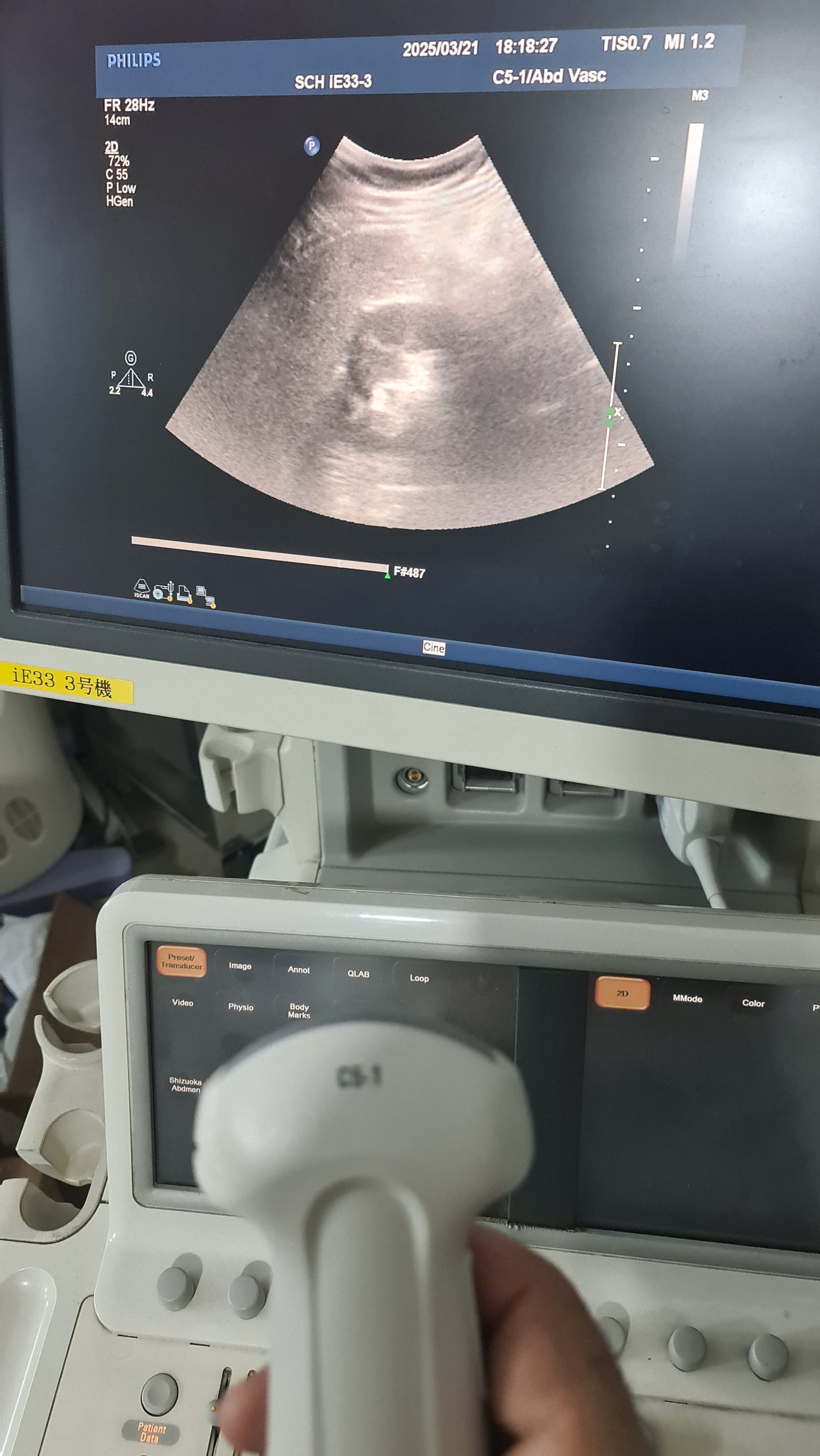 ...Philips C5-1 Convex Probe Checked DXB