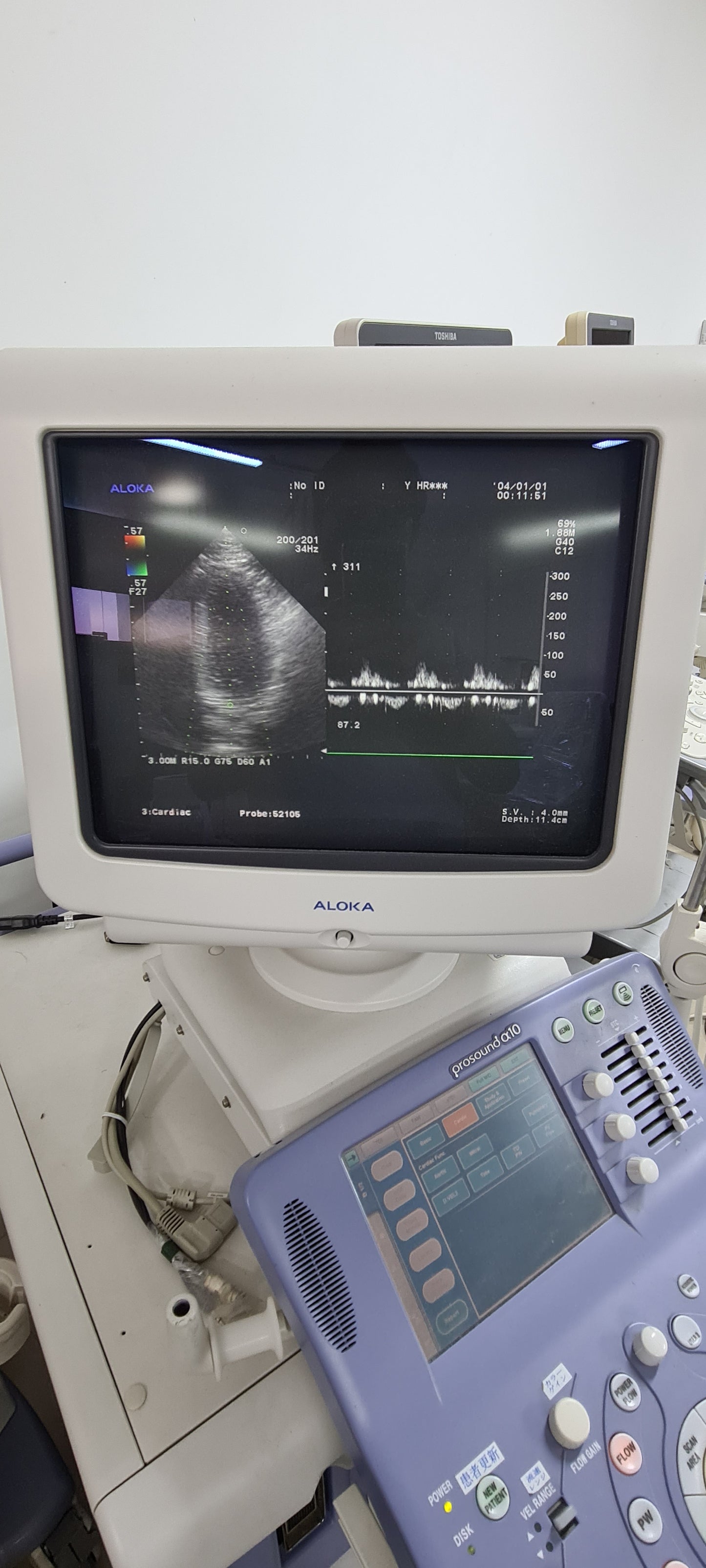 Aloka UST-52105 Cardiac prob checked SN:M01955