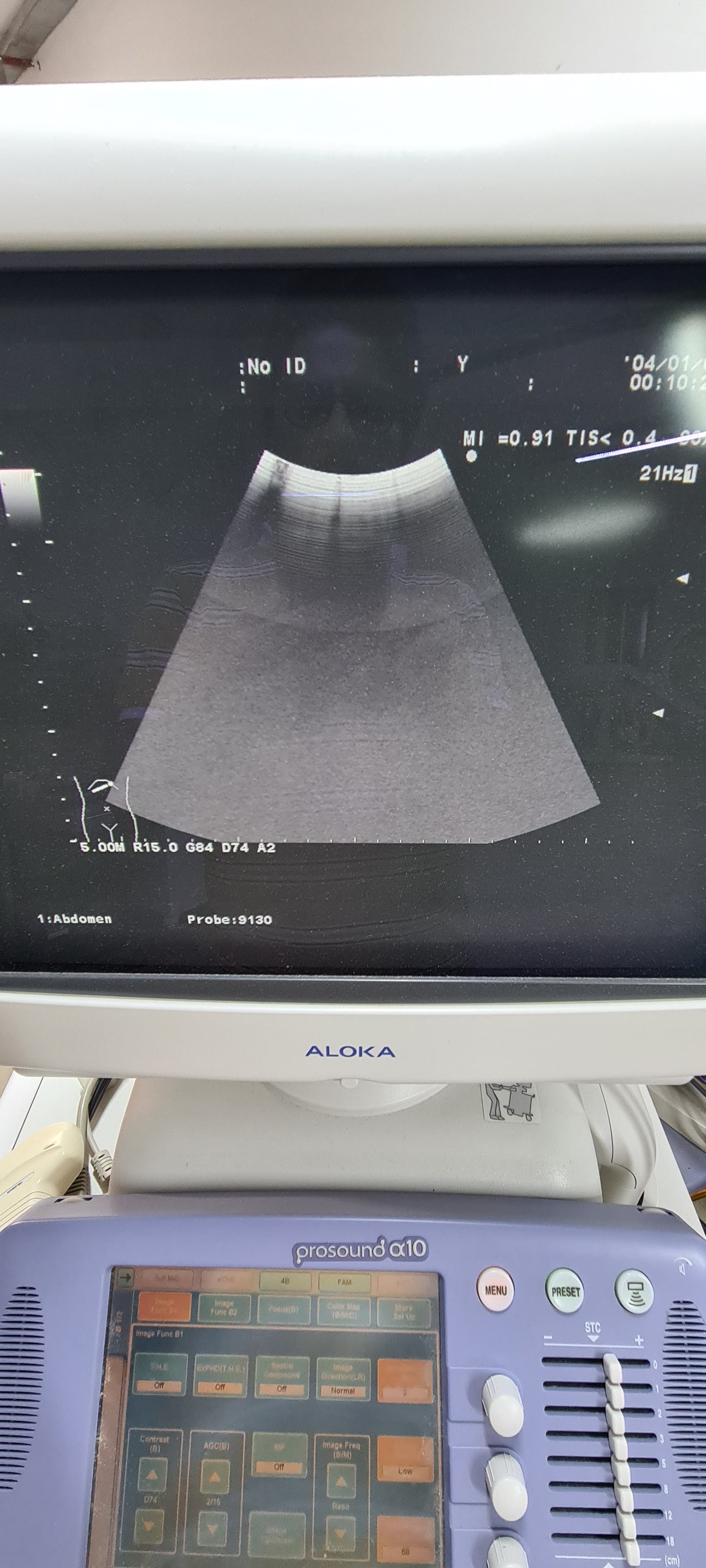 Aloka UST-9130 CONVEX checked Av. SN. X0061338