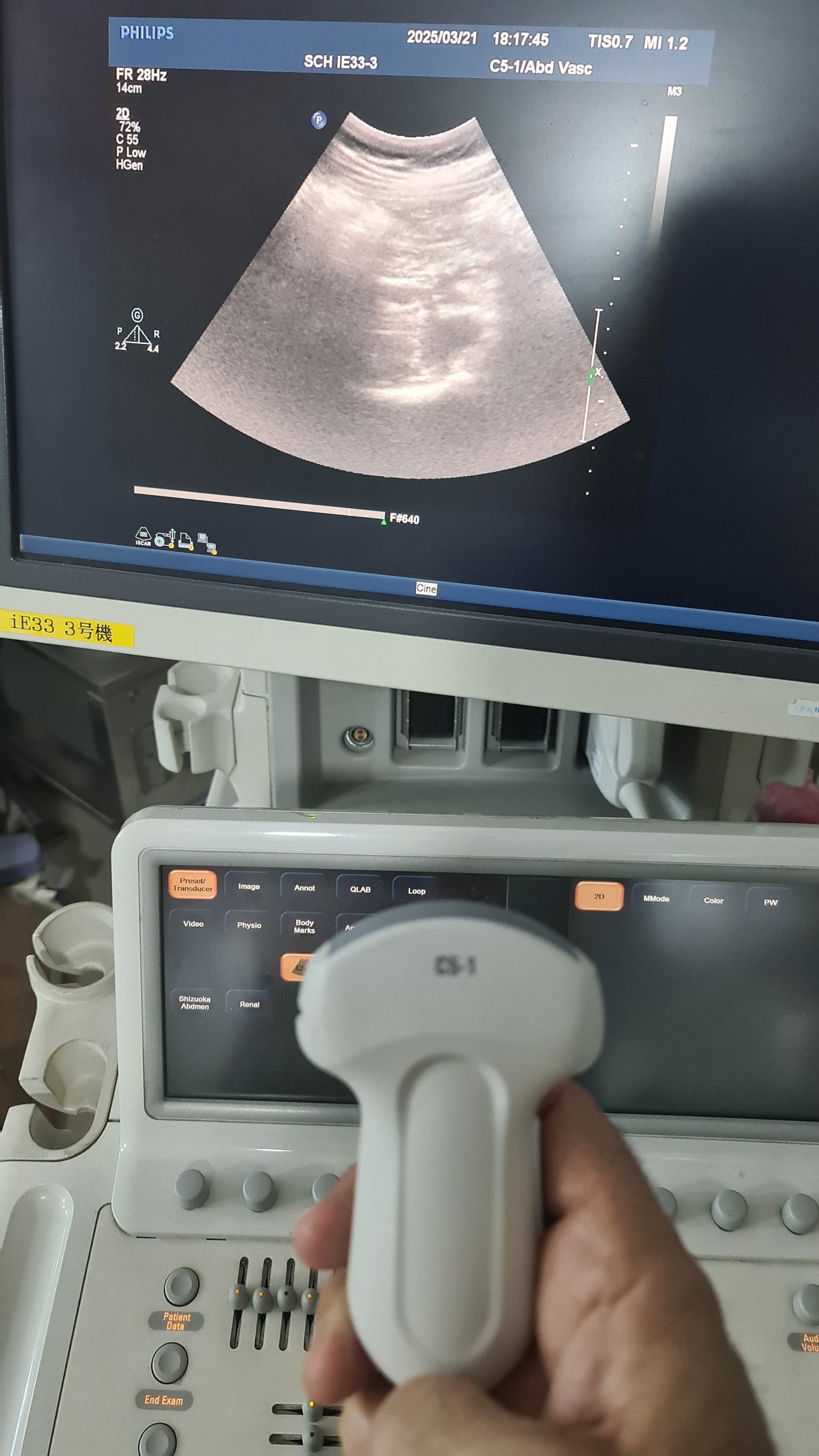 ...Philips C5-1 Convex Probe Checked DXB