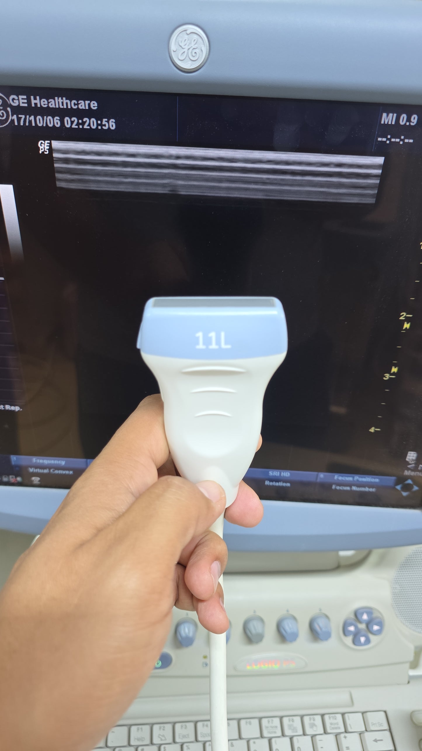 GE 11L Linear probe for logiq p5,p6 mfg: 2014