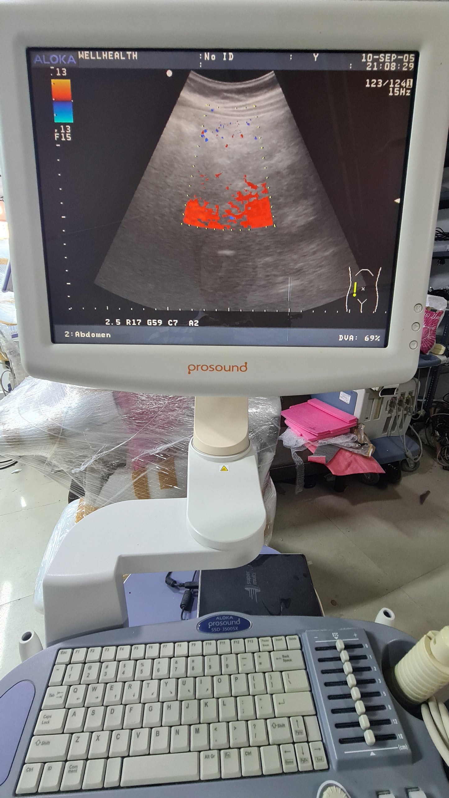 Z..Aloka UST-9123 Convex Probe checked SN X0084061 dxb