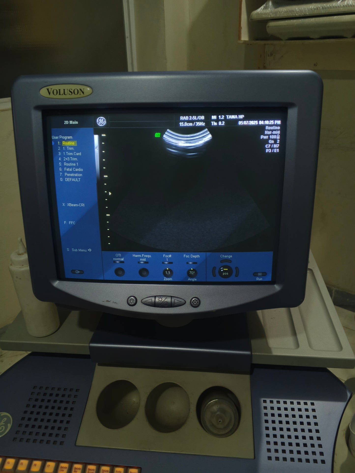 GE voluson 730 pro v 4D probe